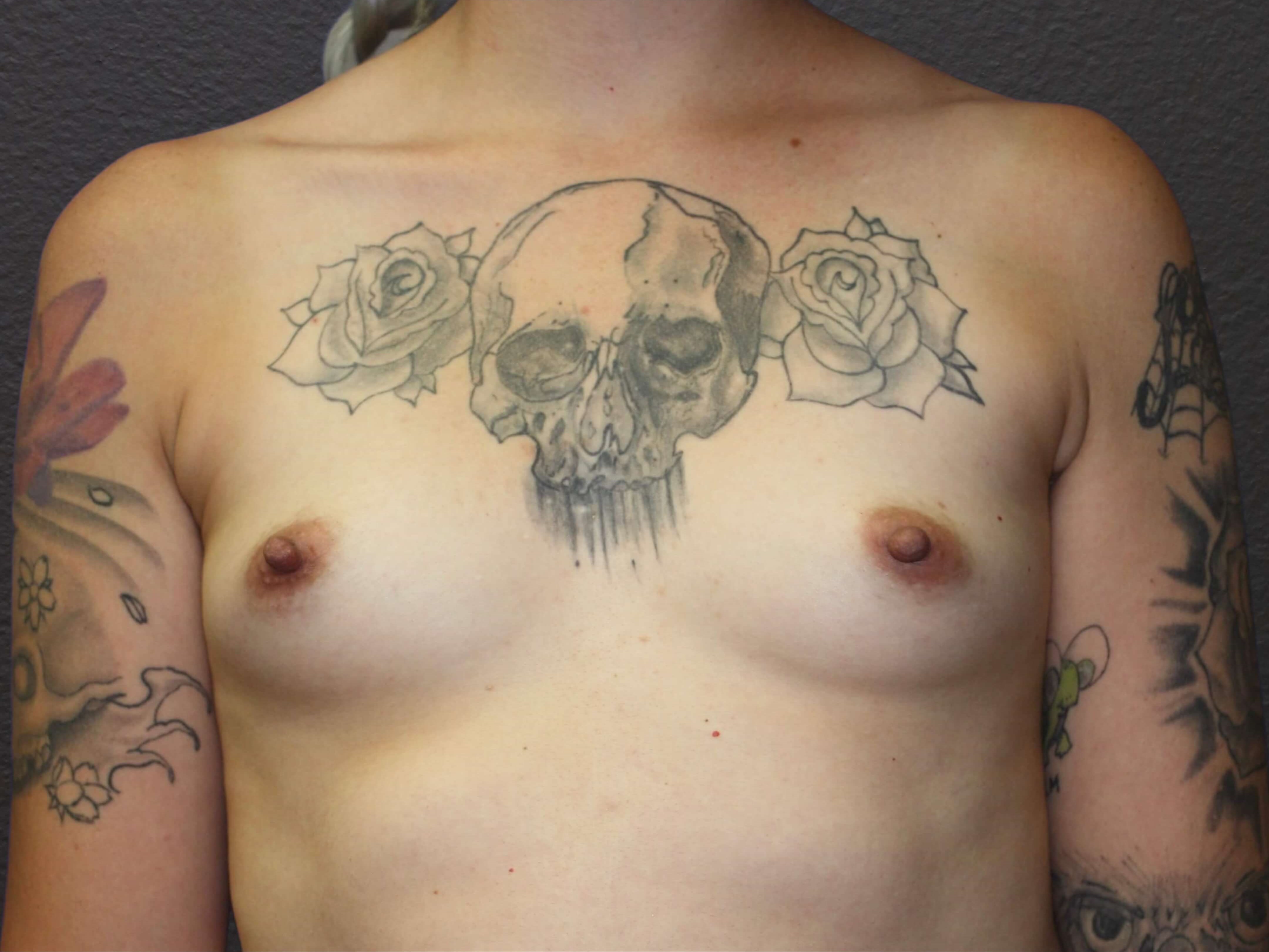 Before Image
