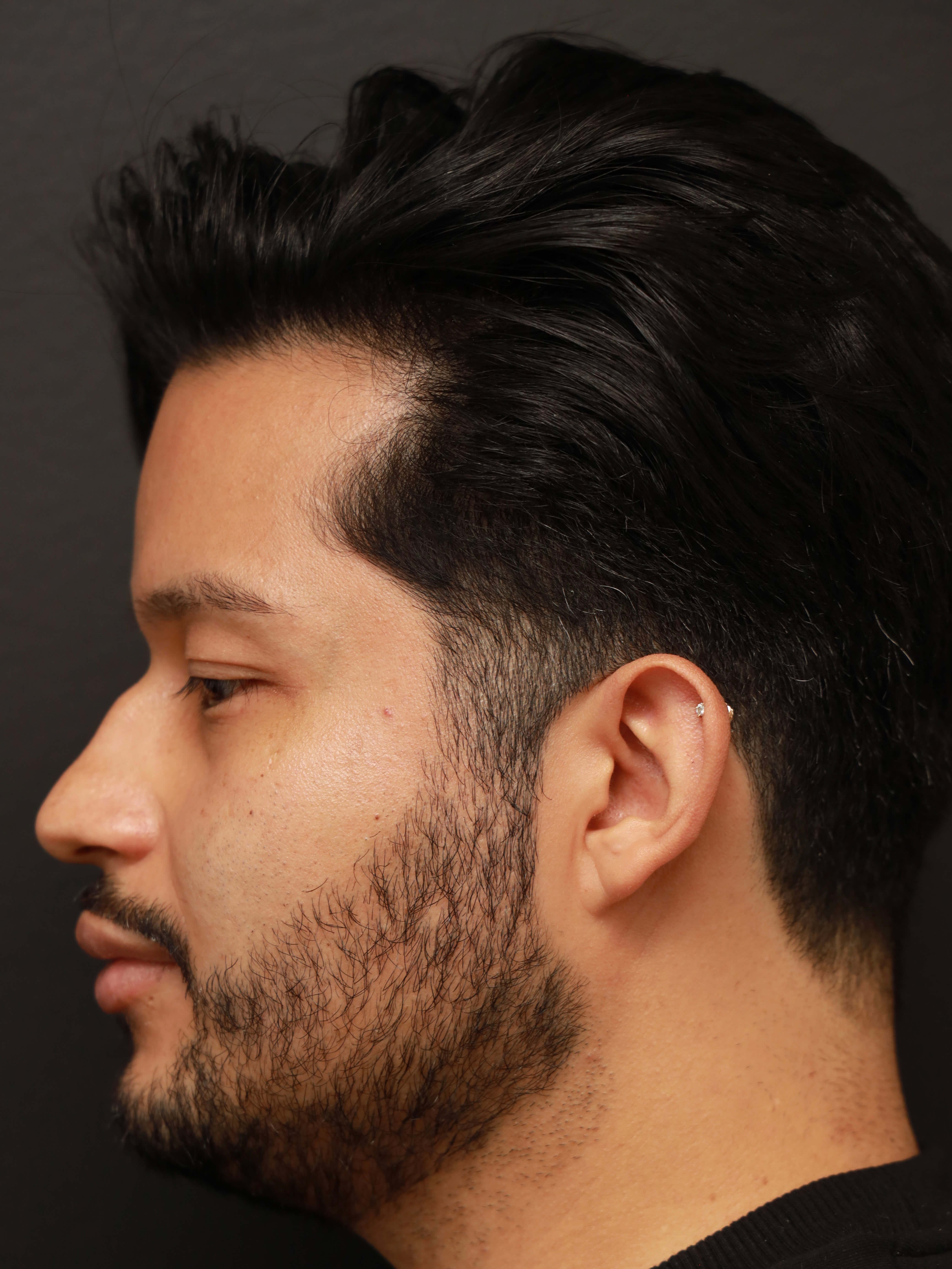 Before Image