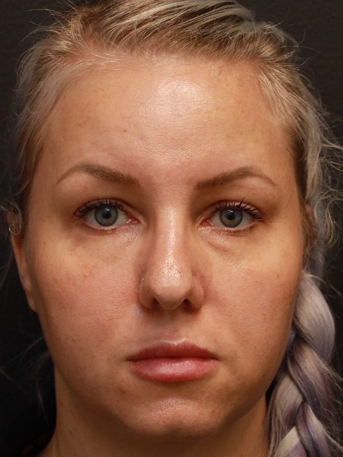 Before Image