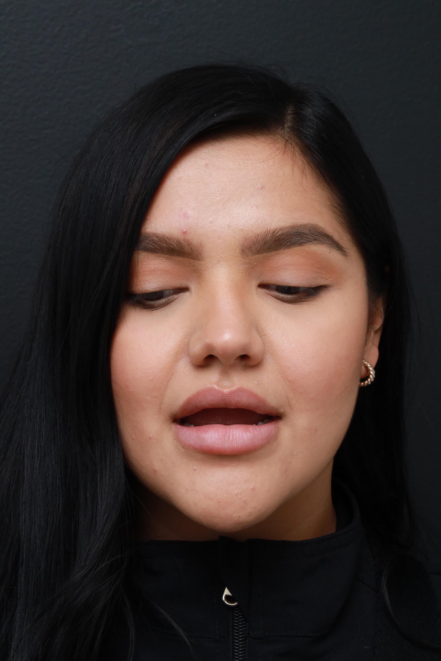 AP Lips Parted Before