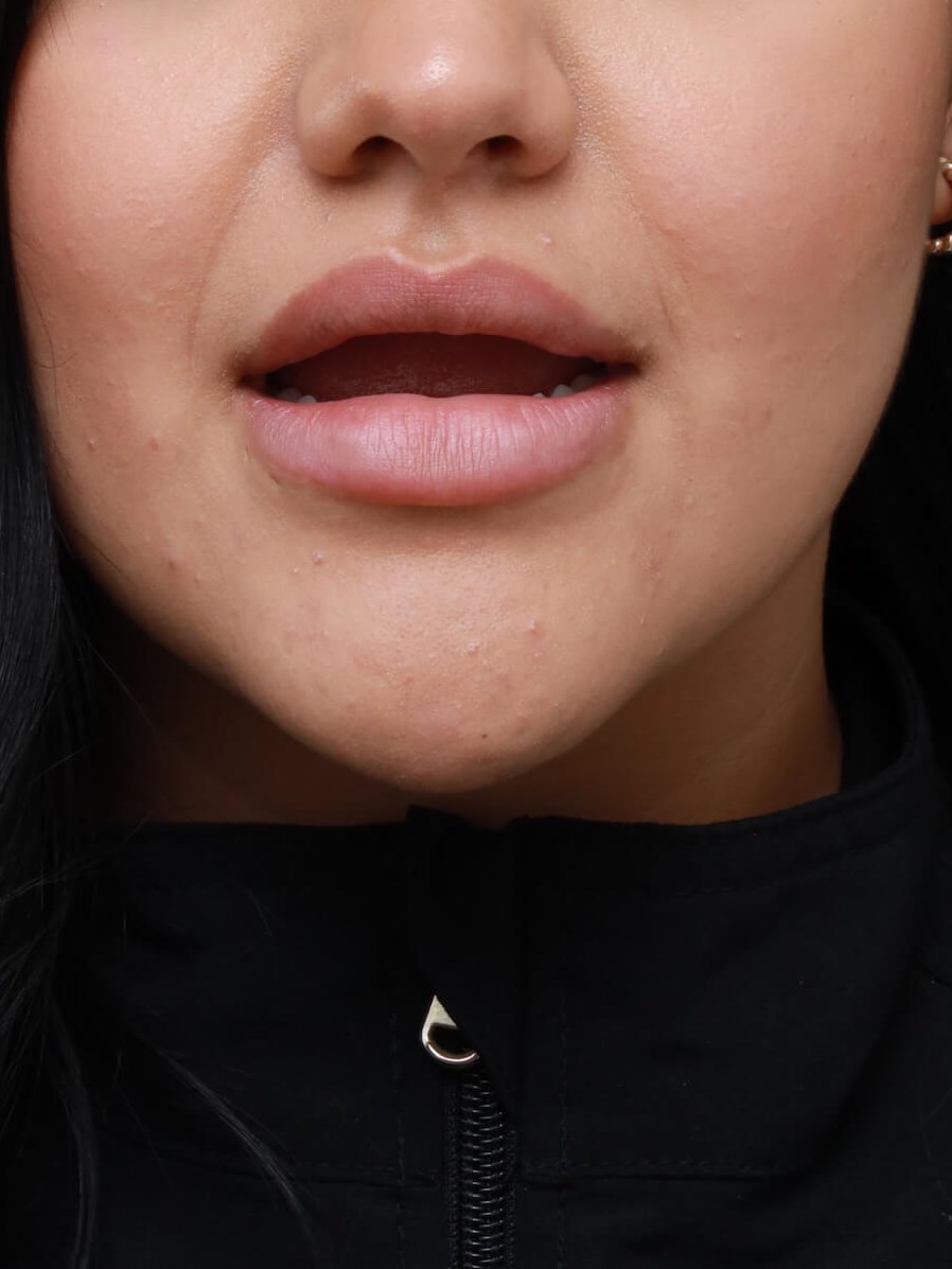 AP Lips Parted Before