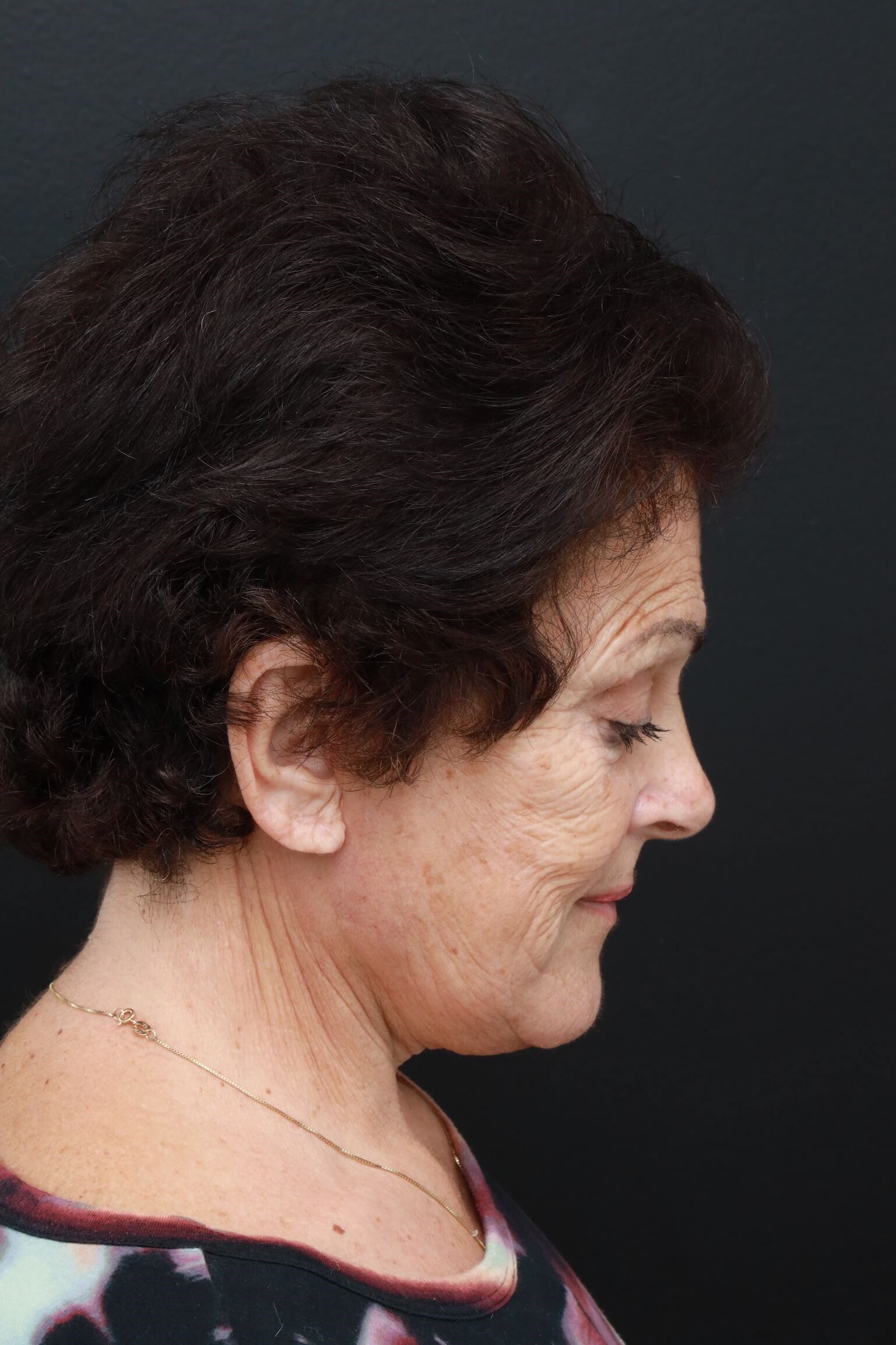 Right Lateral Neck Flexed After