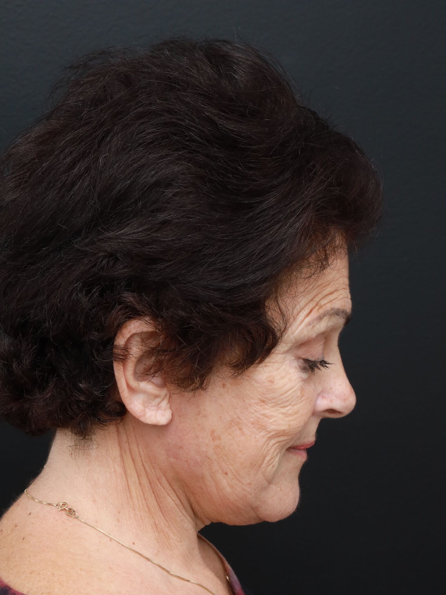 Right Lateral Neck Flexed After