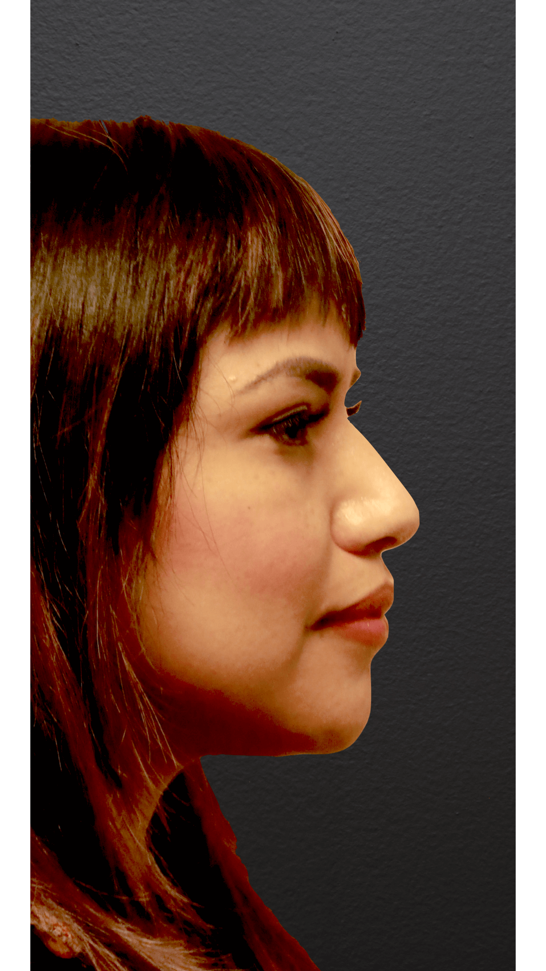 Right Lateral Before