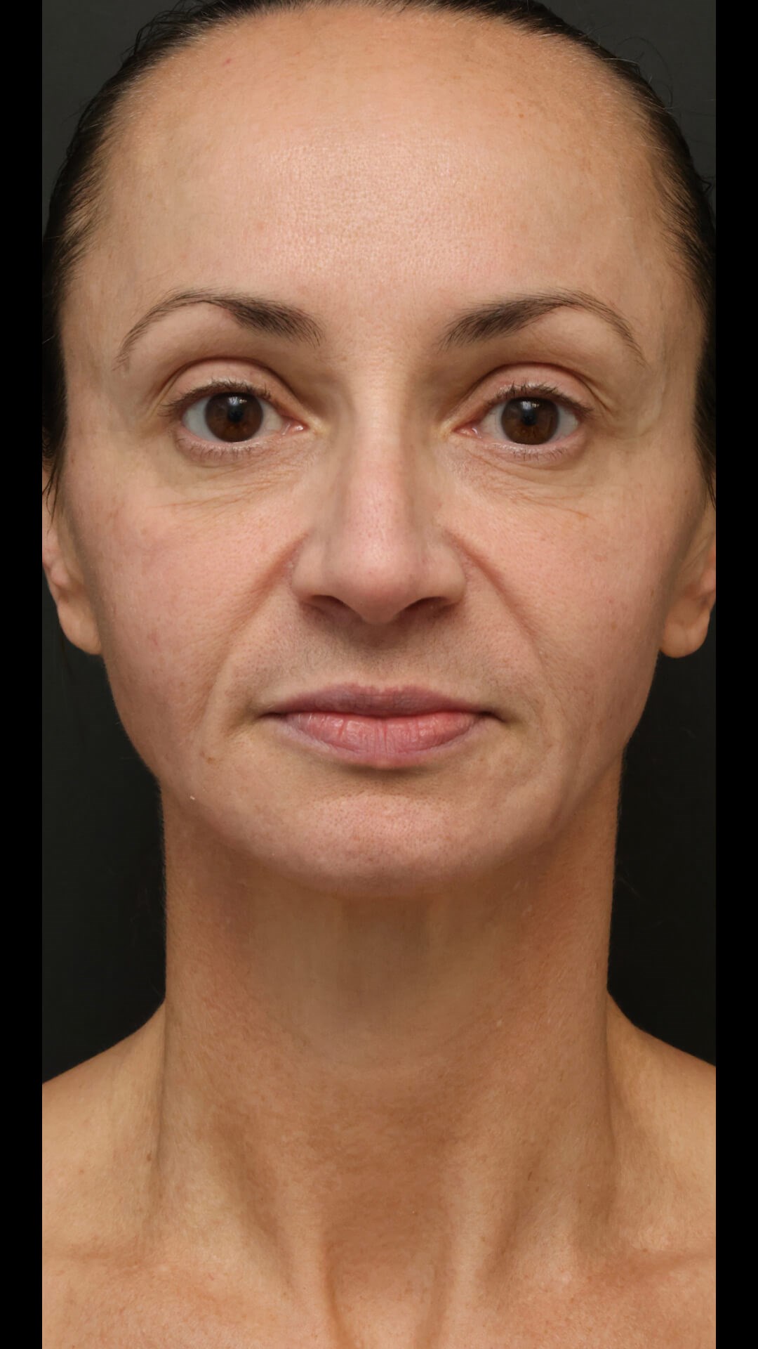 After Image