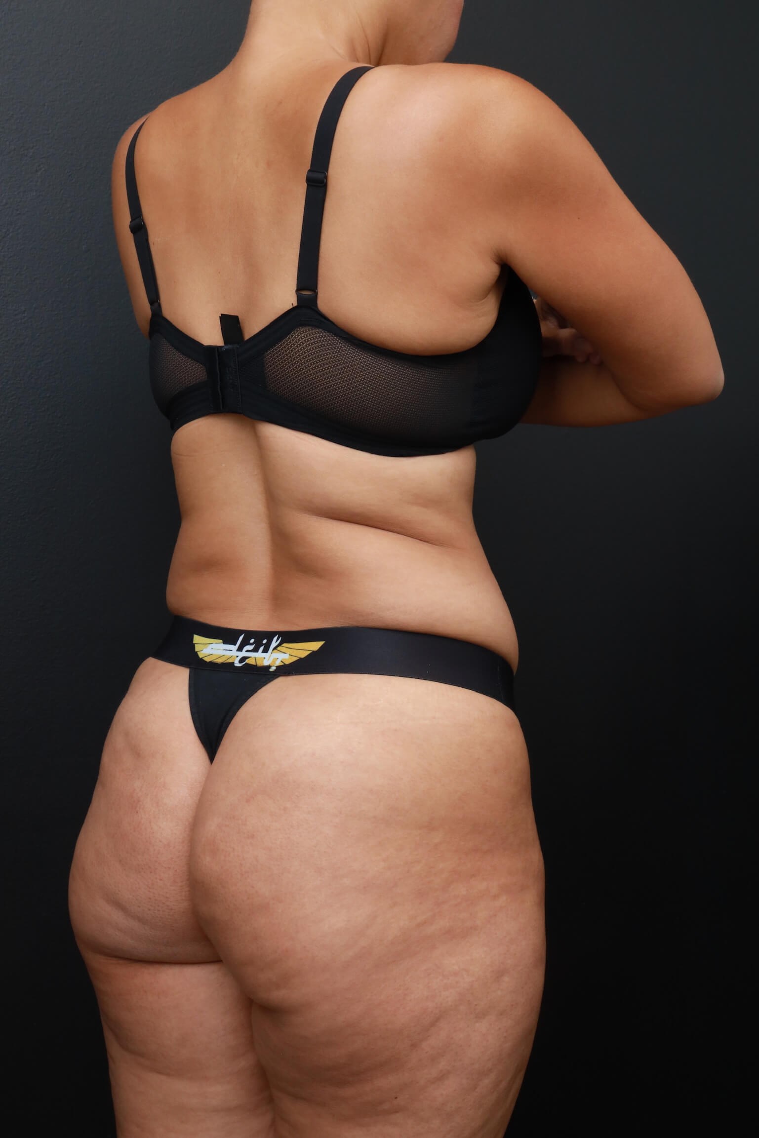 Right Back Oblique Before