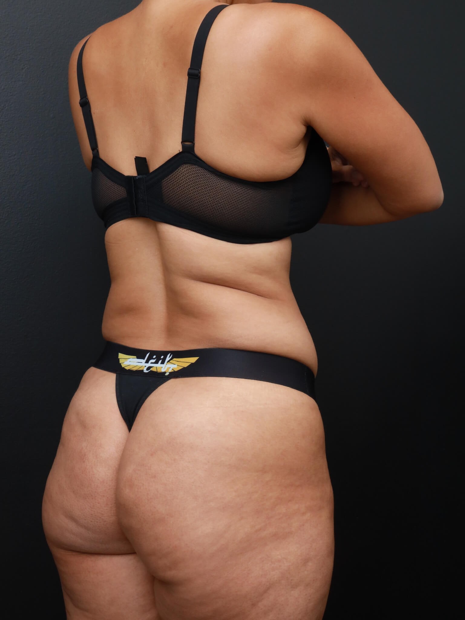 Right Back Oblique Before