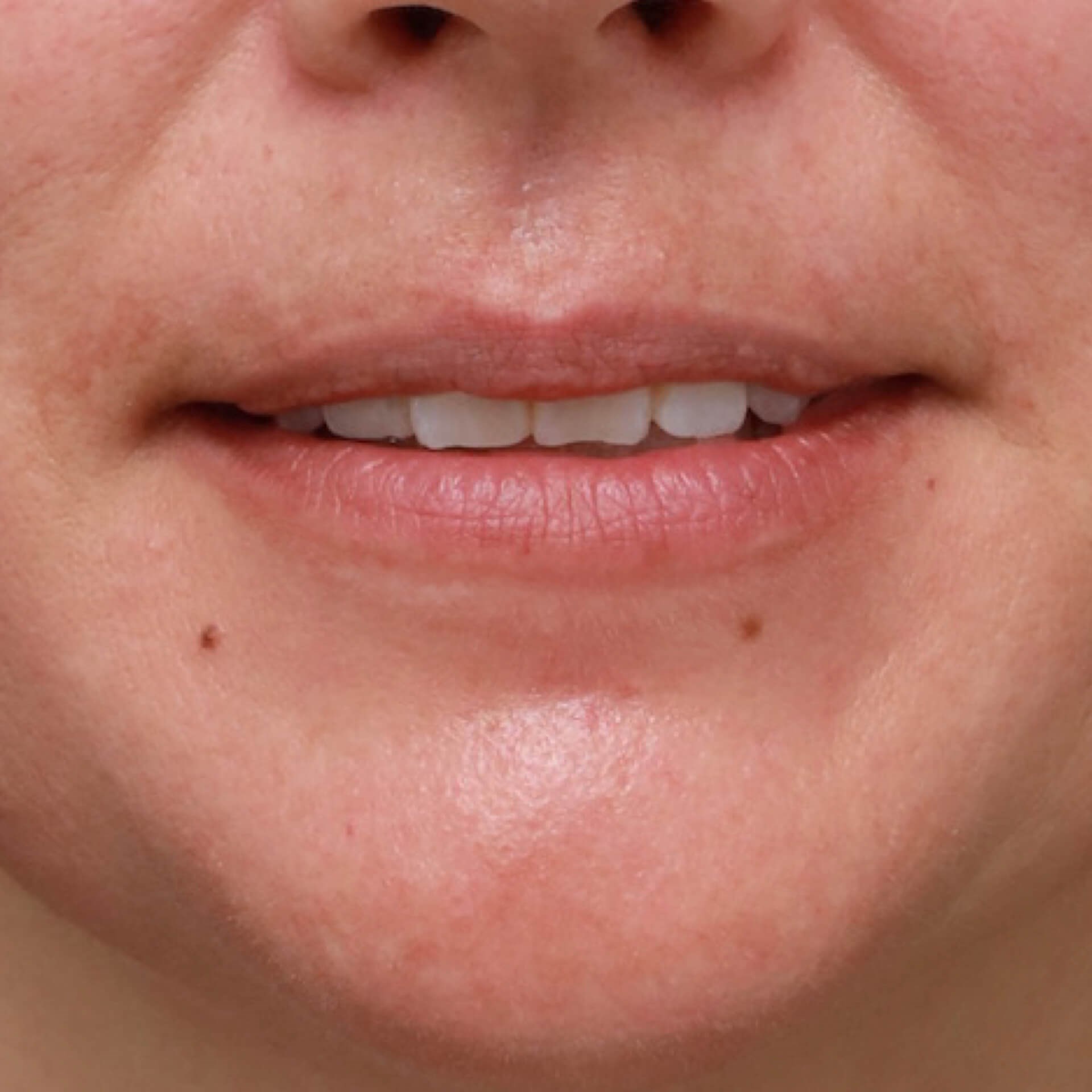 AP Lips Parted Before