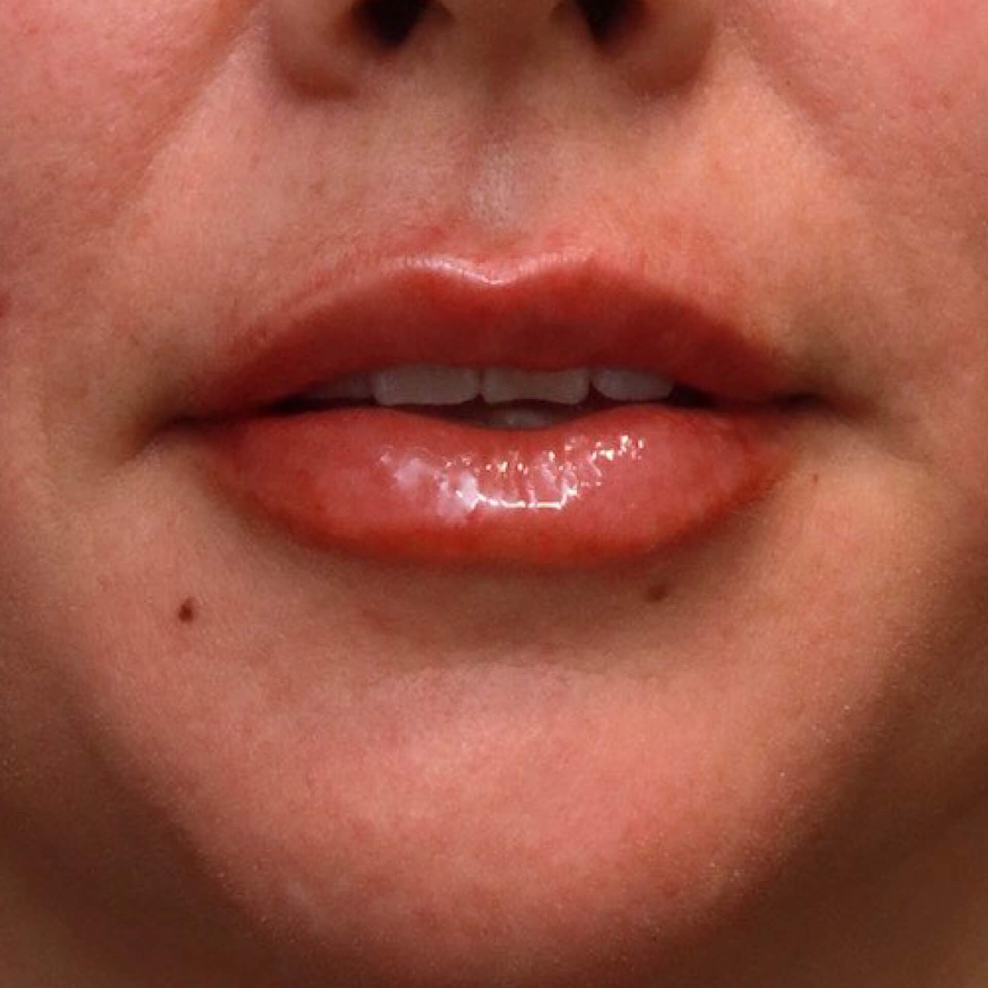 AP Lips Parted After