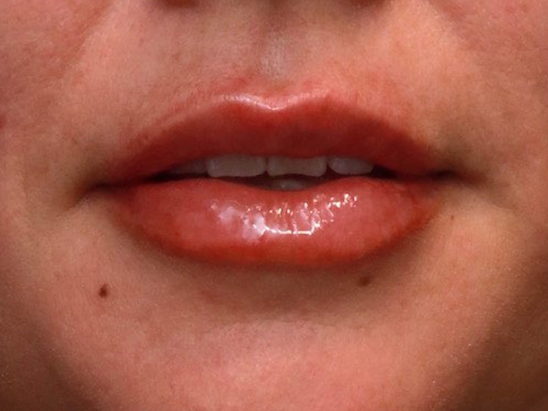 AP Lips Parted After