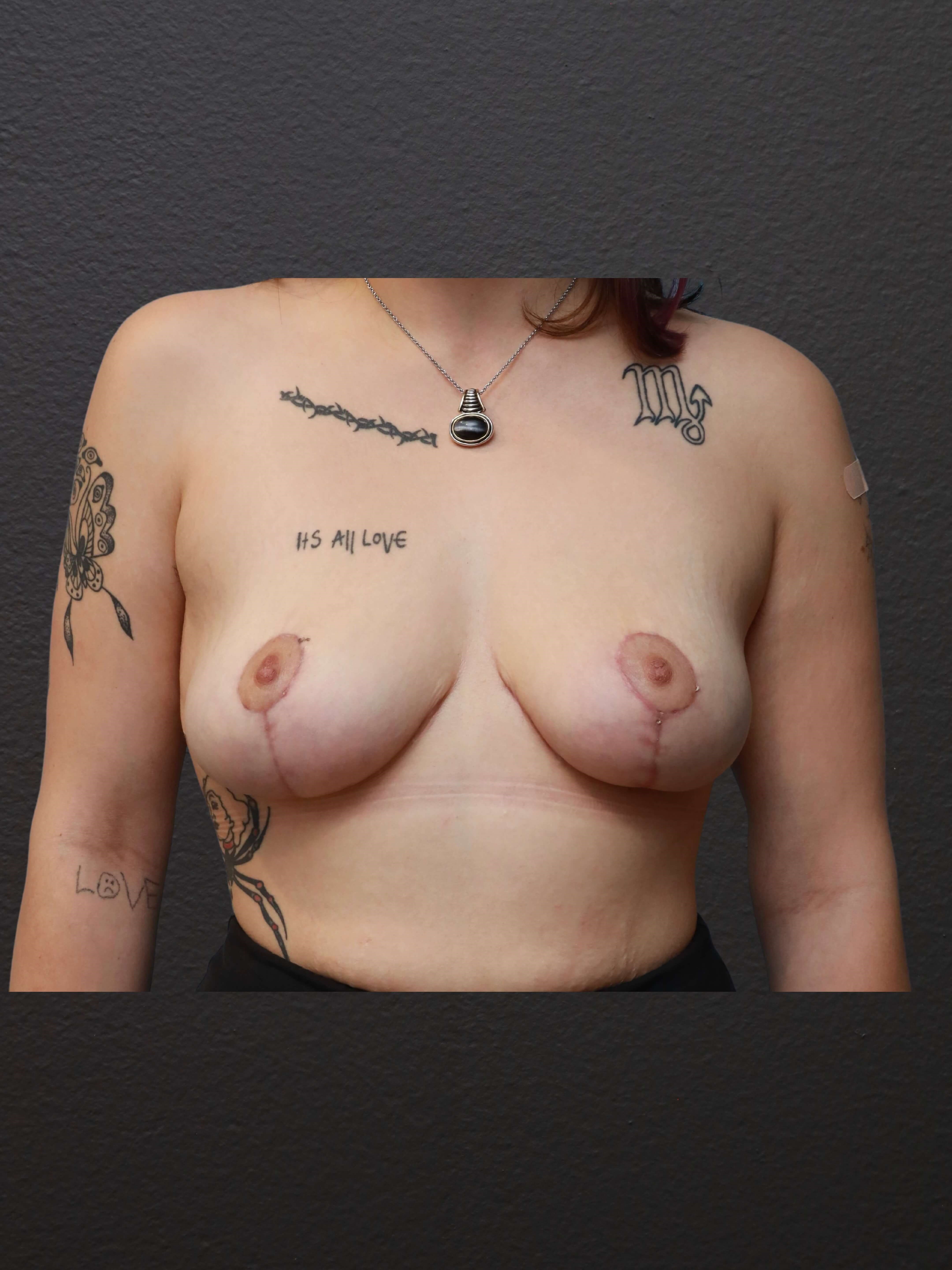After Image