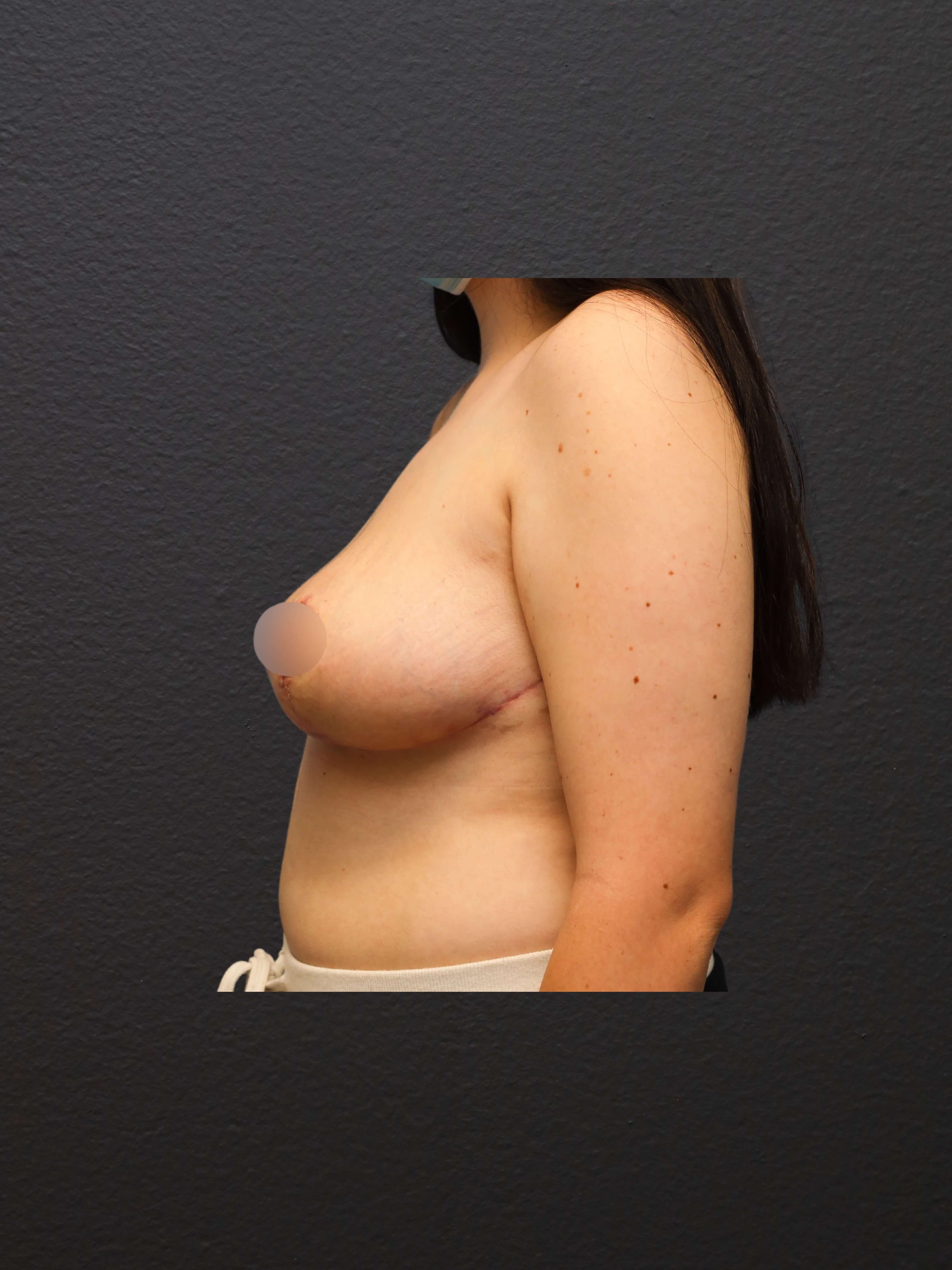 After Image