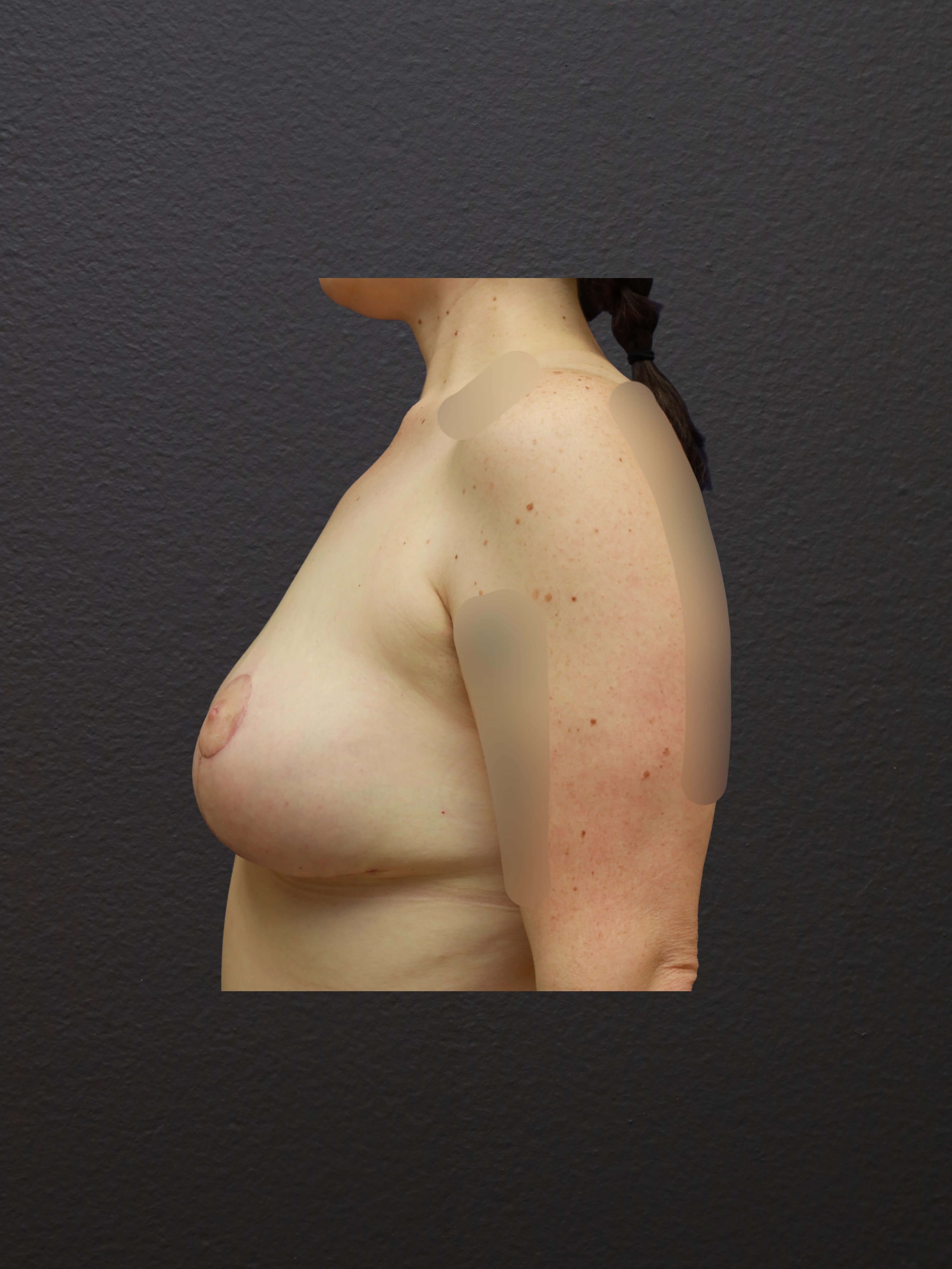After Image