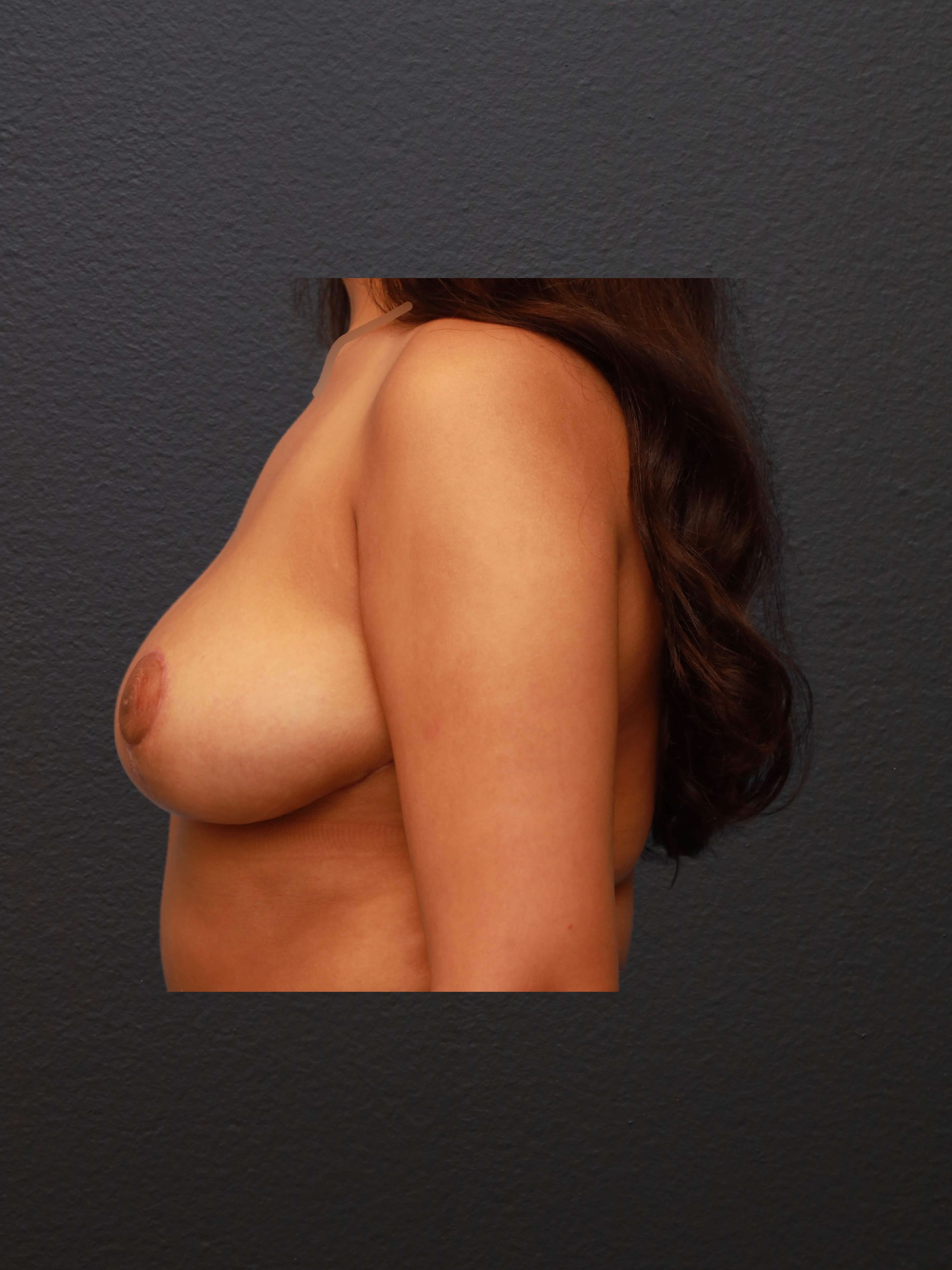 After Image