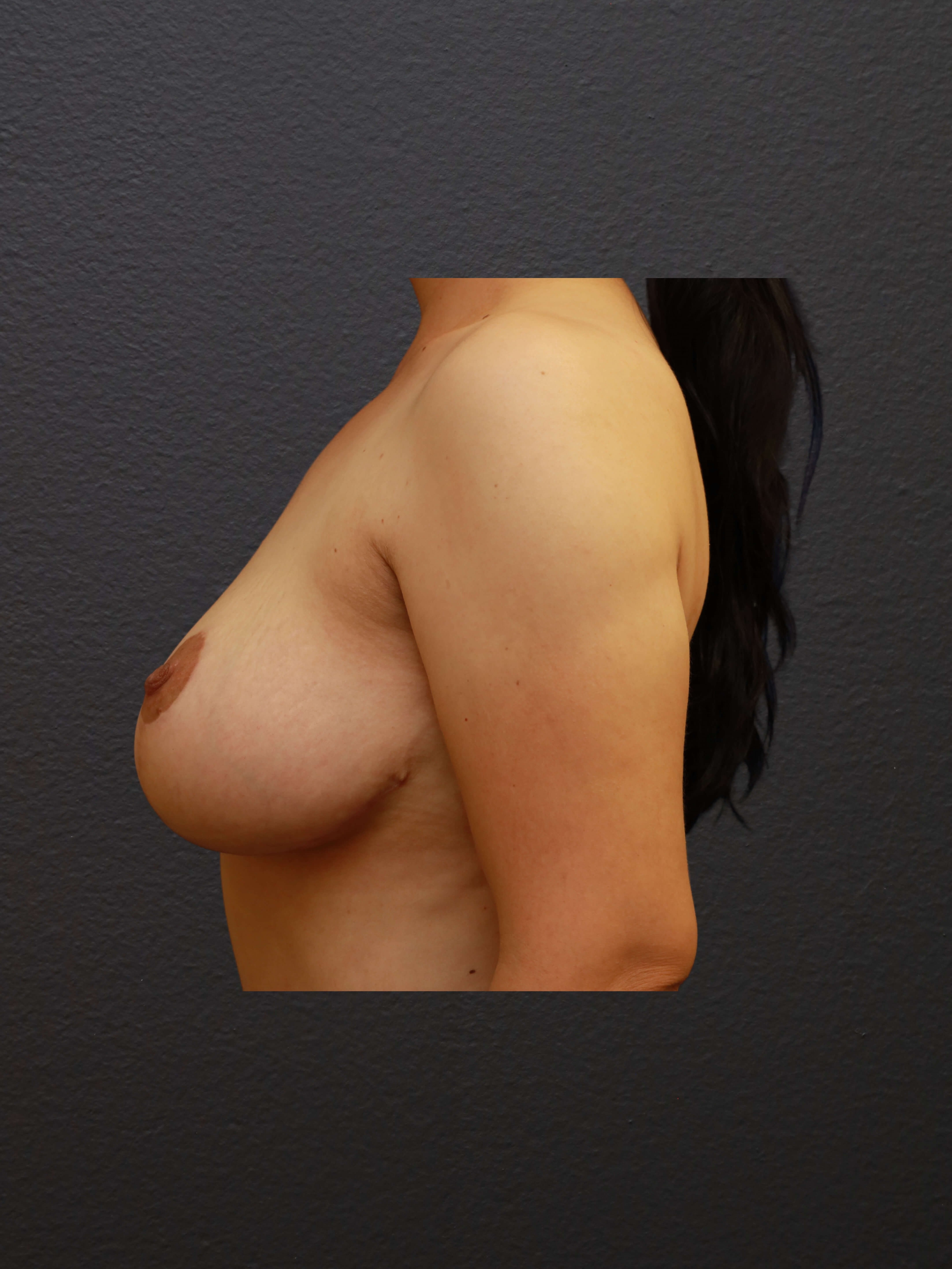After Image