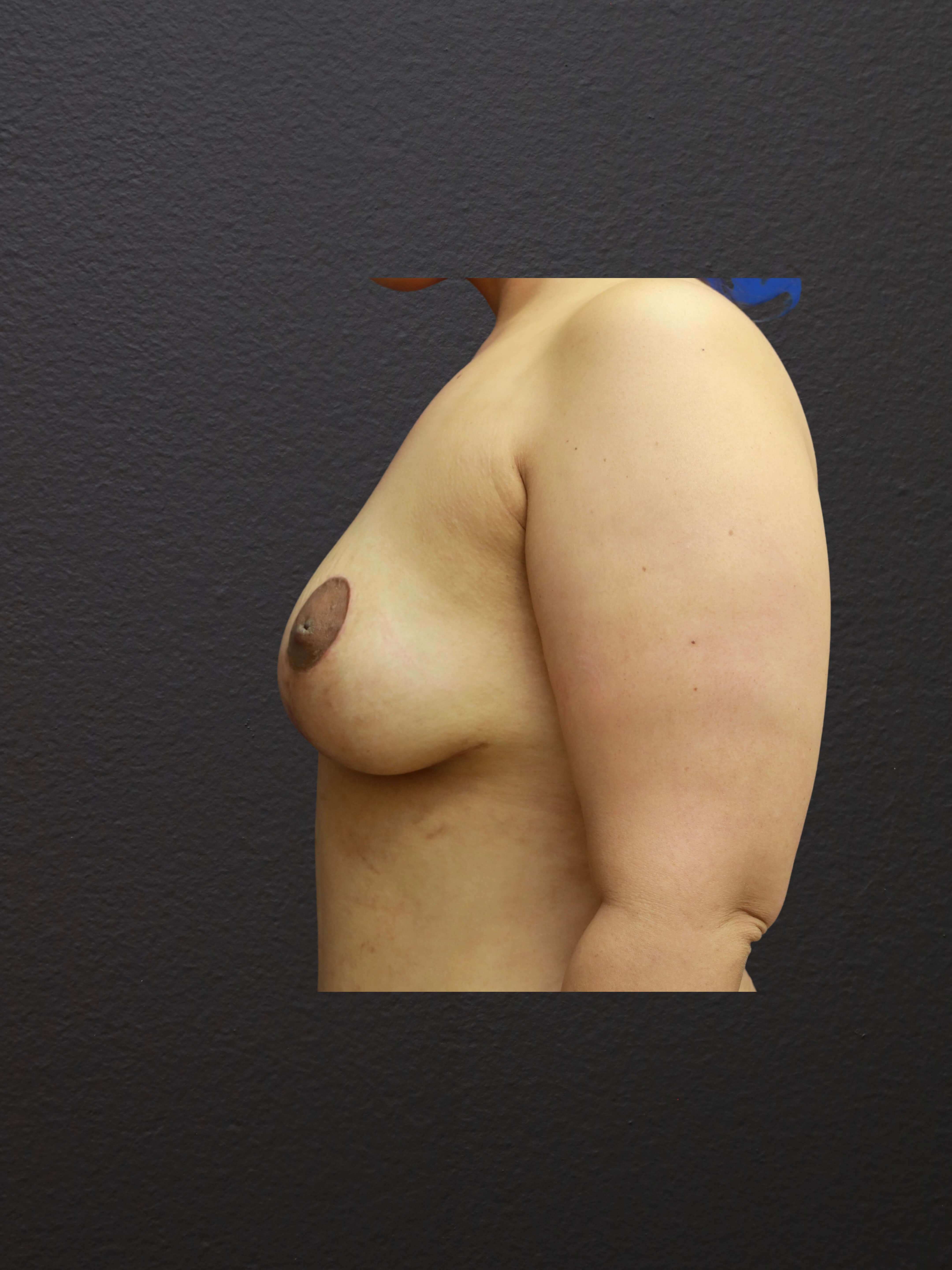After Image