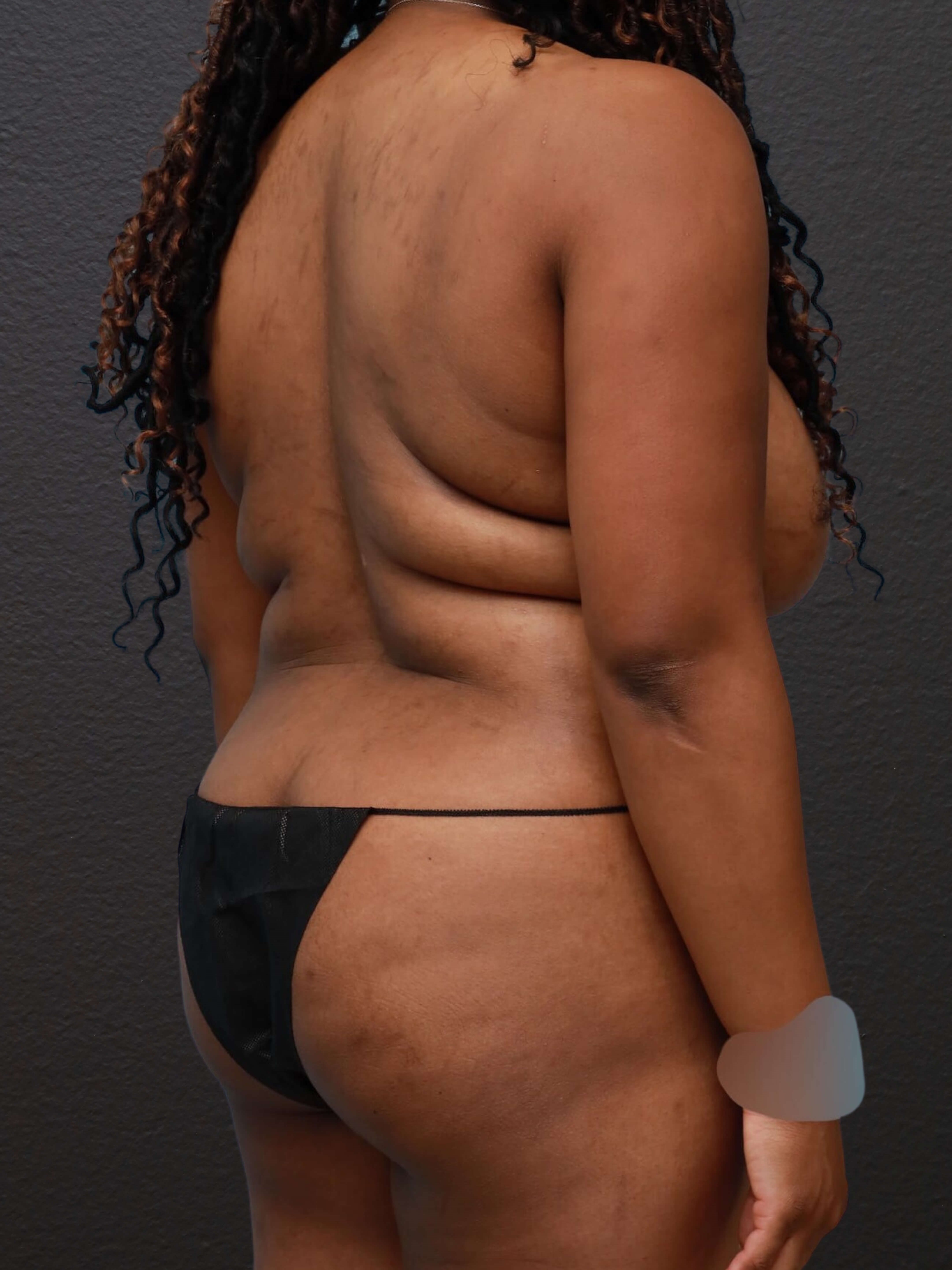 Right Back Oblique Before