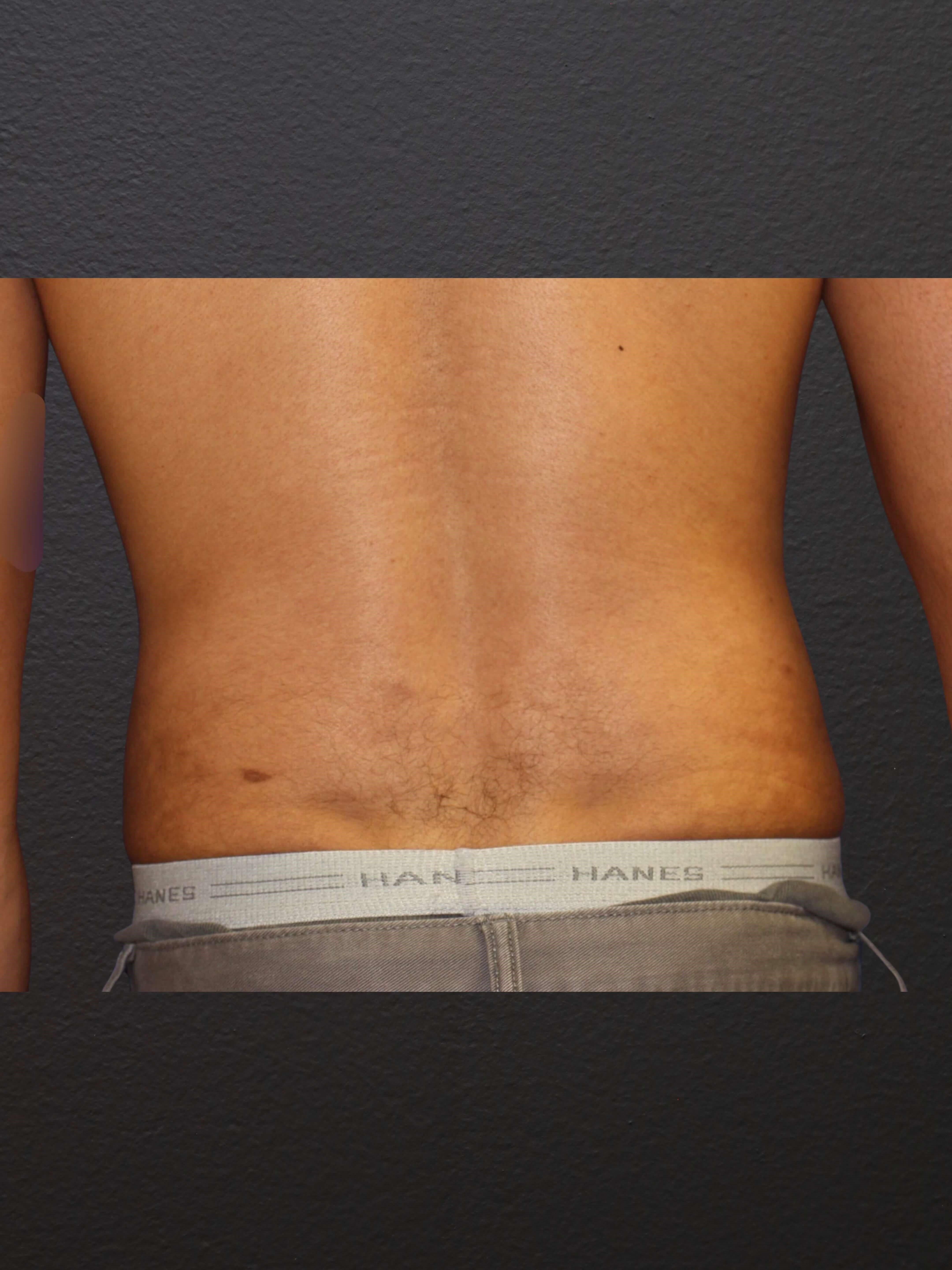 POSTERIOR After