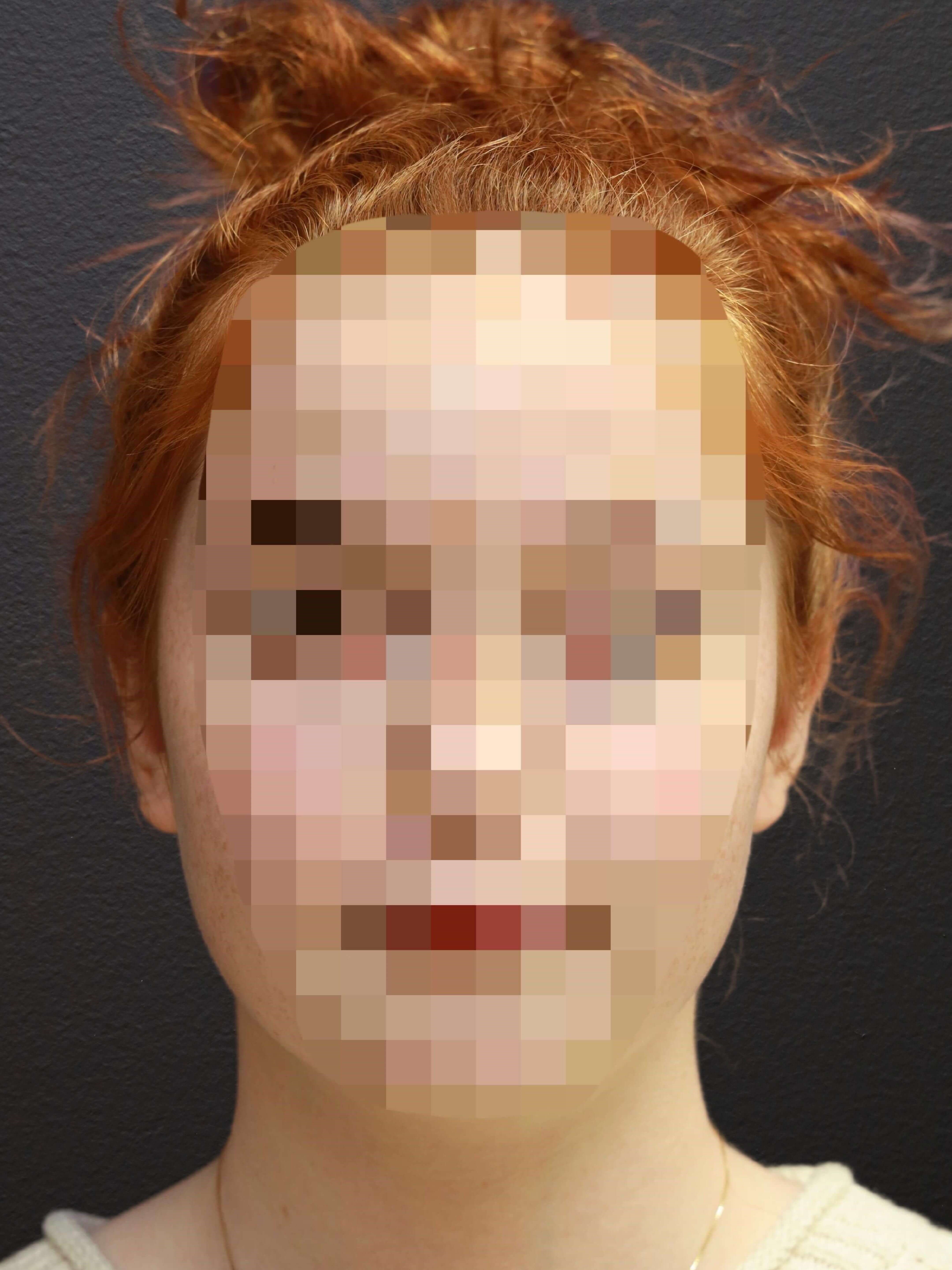 After Image