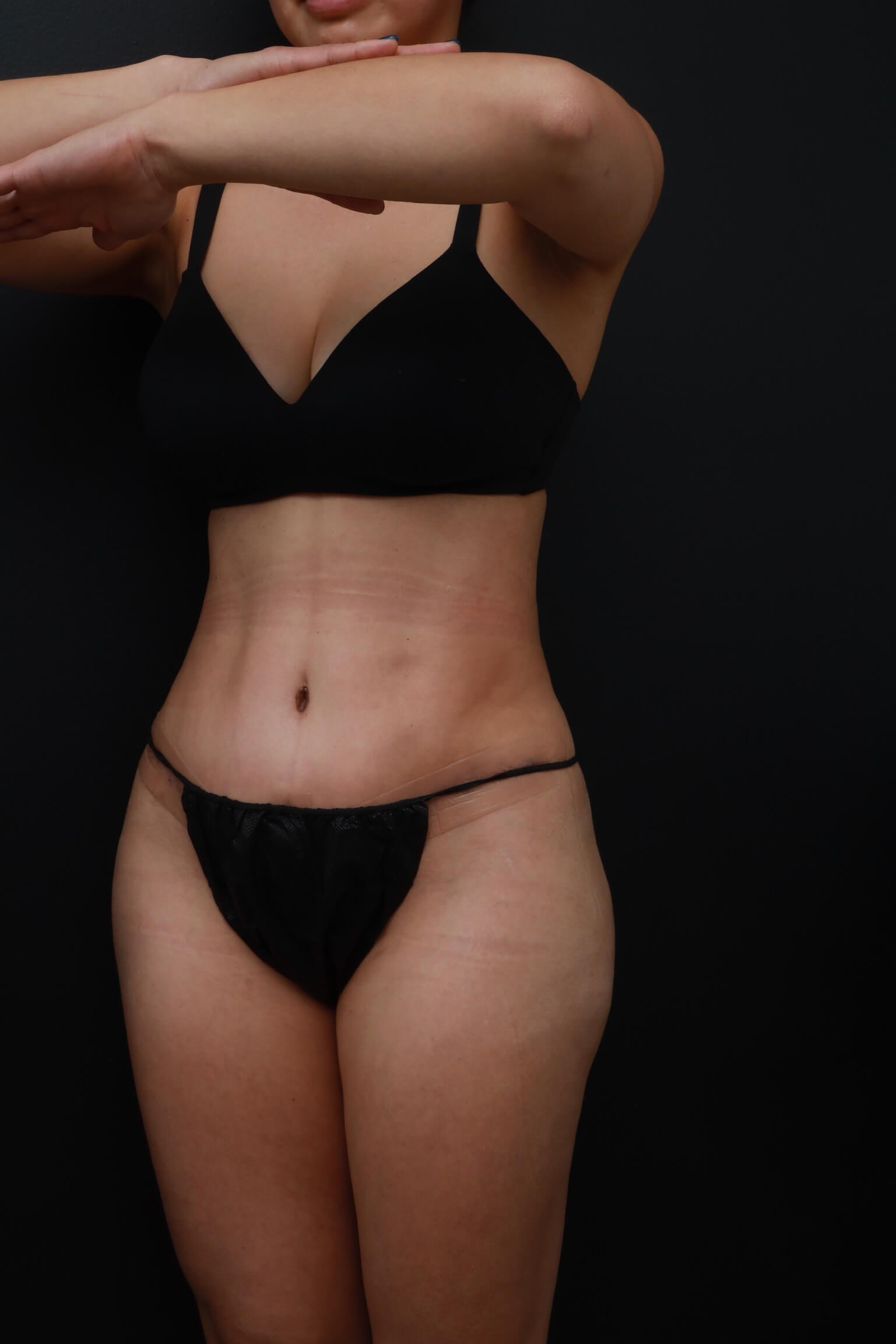 Left Oblique After