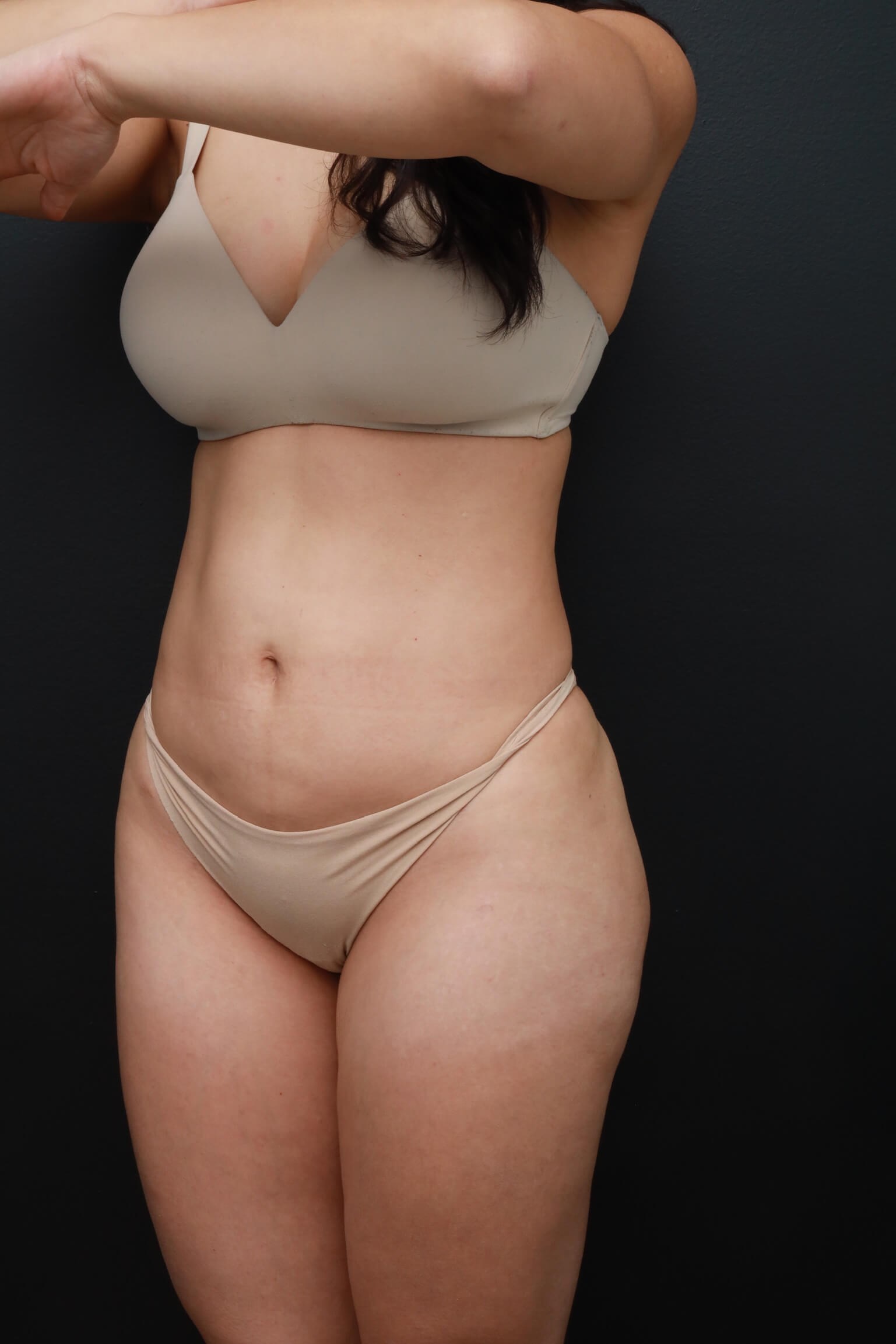 Left Oblique Before
