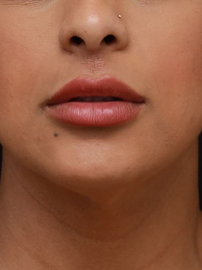 AP Lips Parted Before