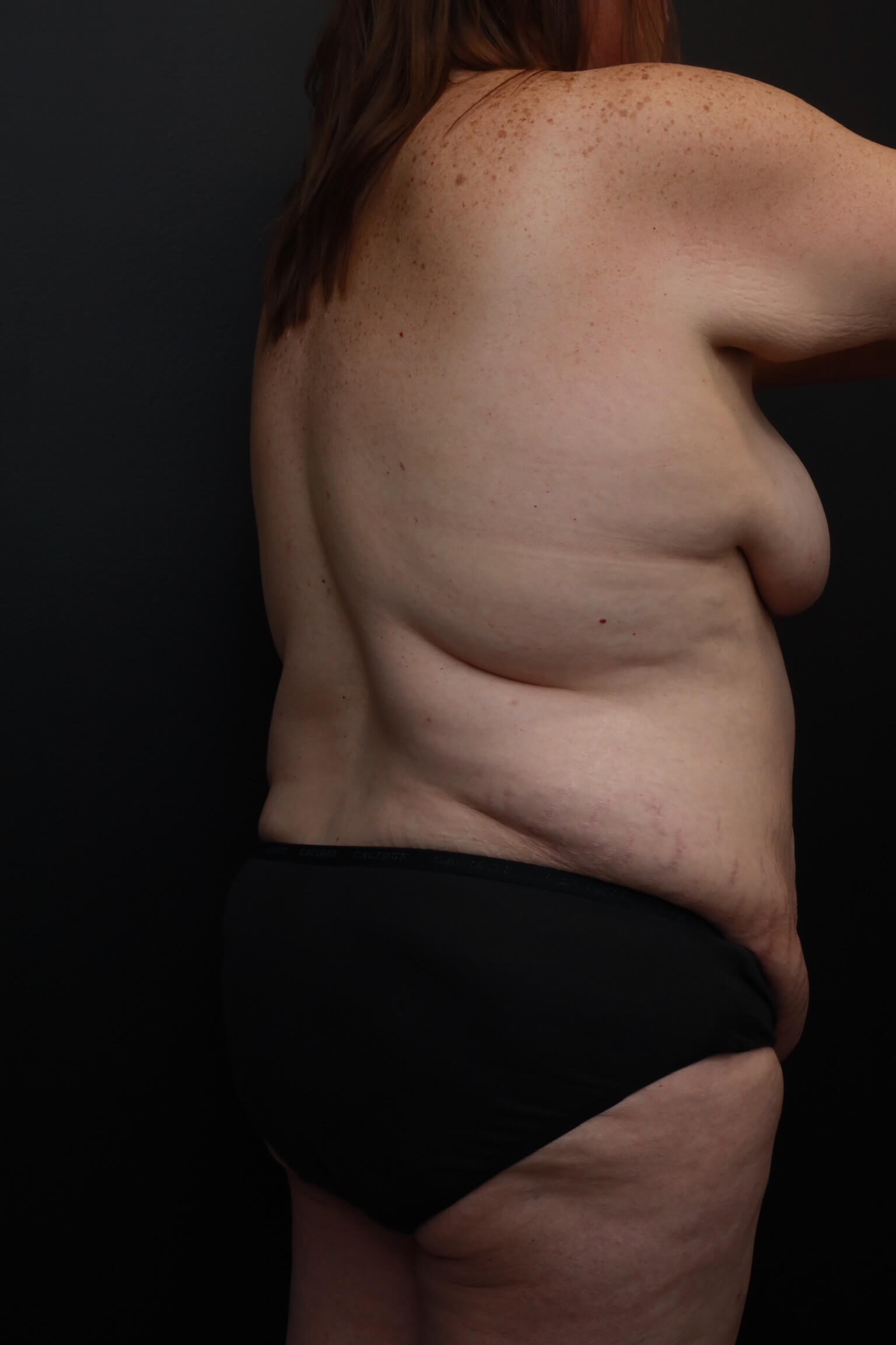 Right Anterior Oblique Before