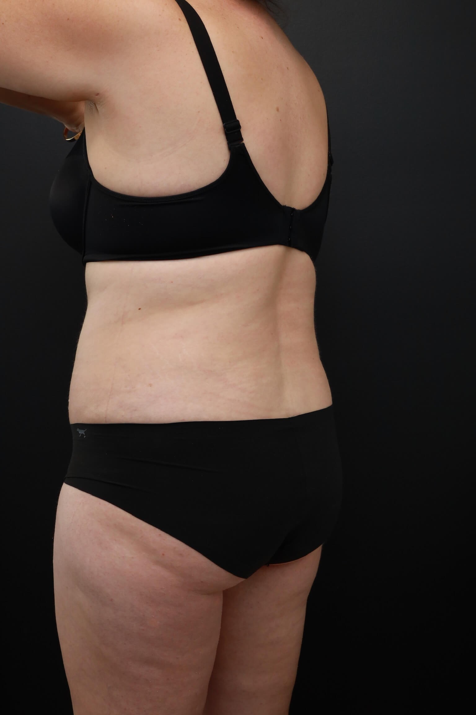 Left Oblique Posterior After