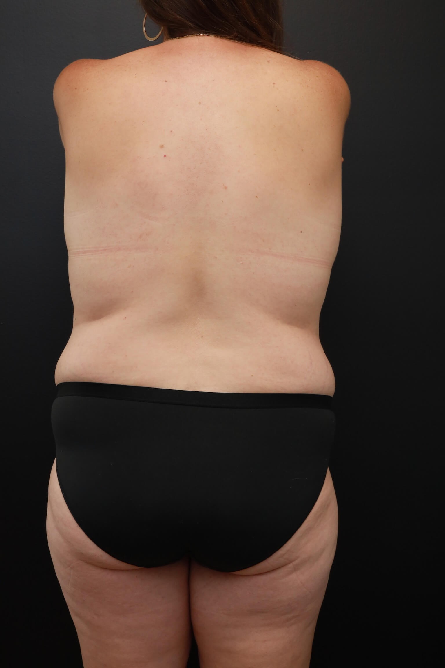 Posterior Before