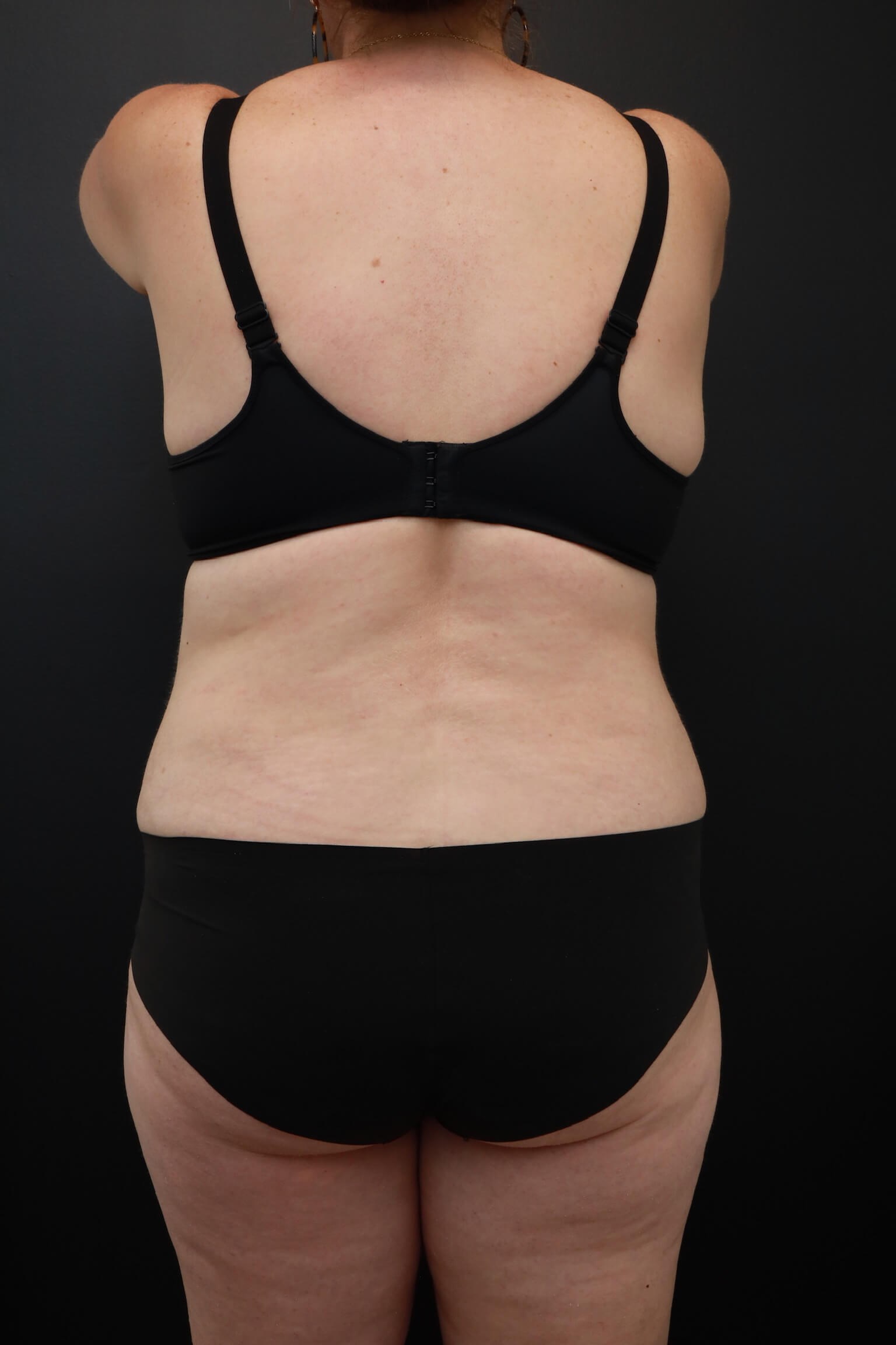 Posterior After