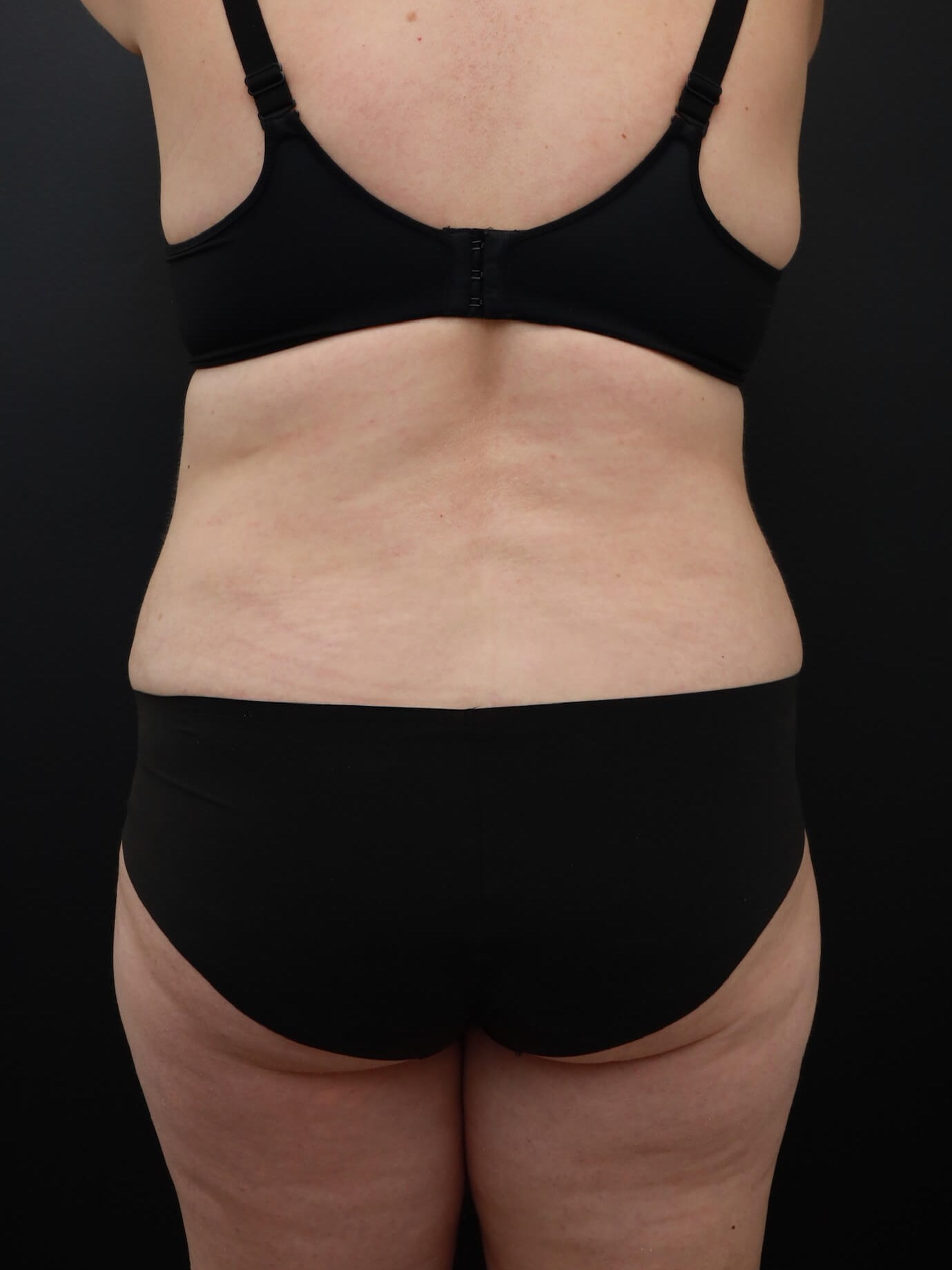 Posterior After