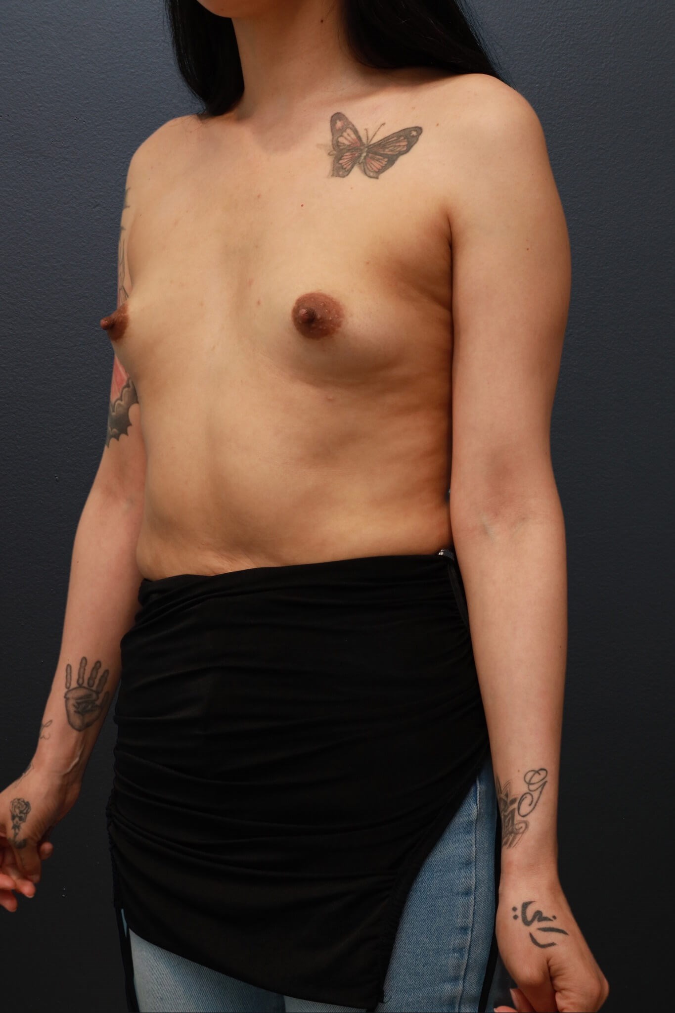 Left Oblique Before