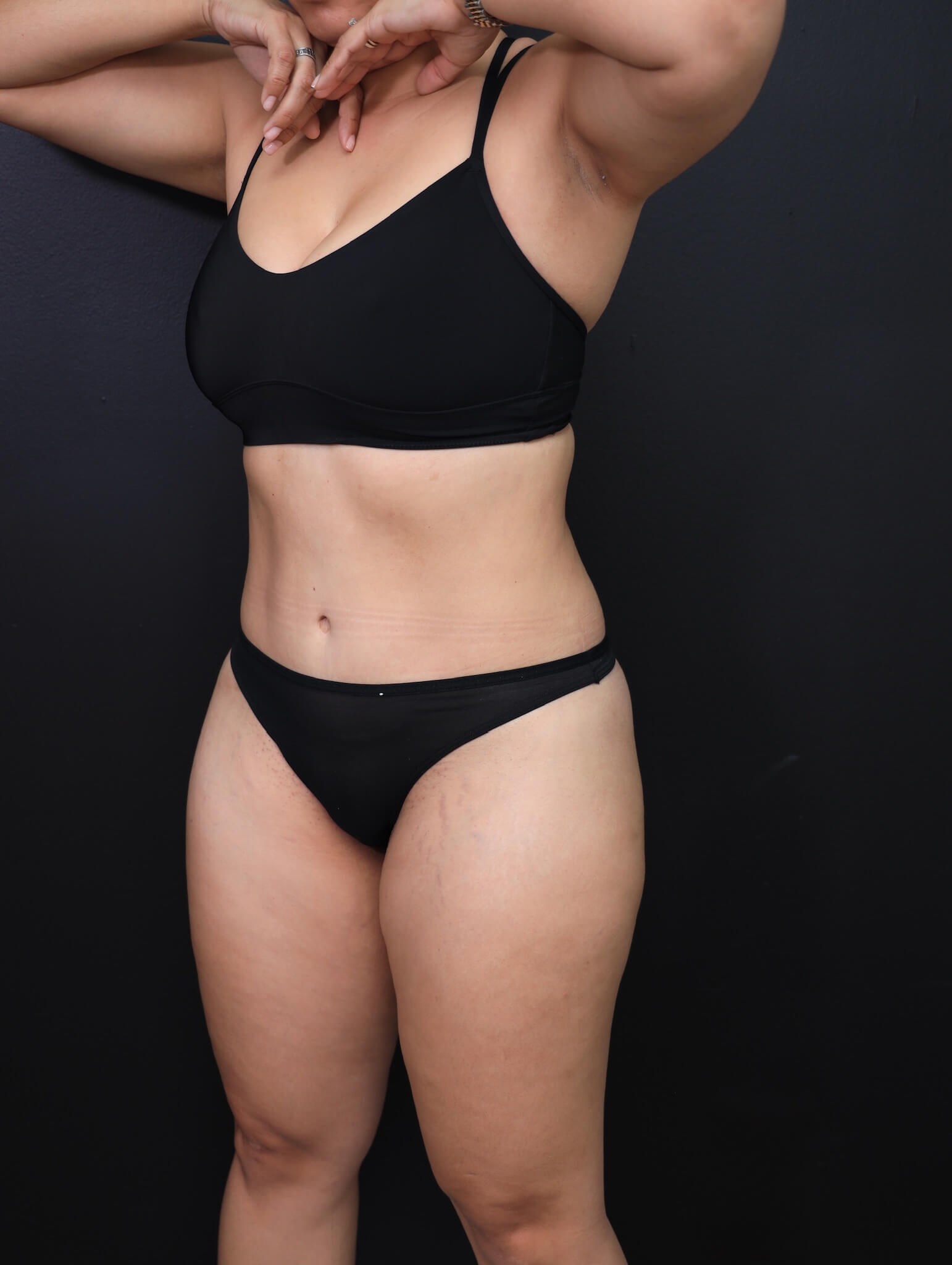 Left Oblique After