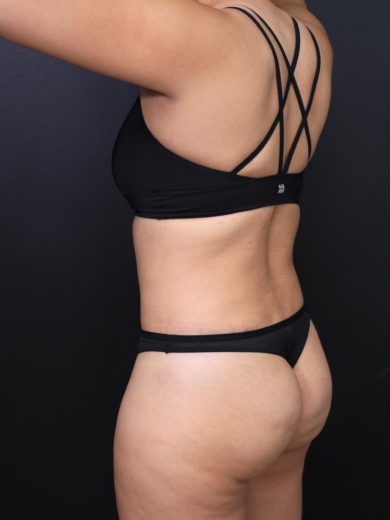 Left Posterior Oblique After