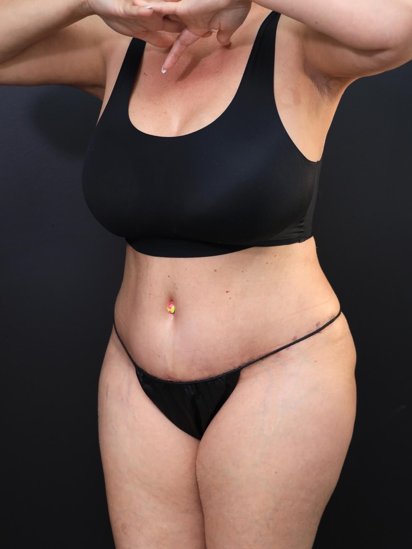 Left Oblique After