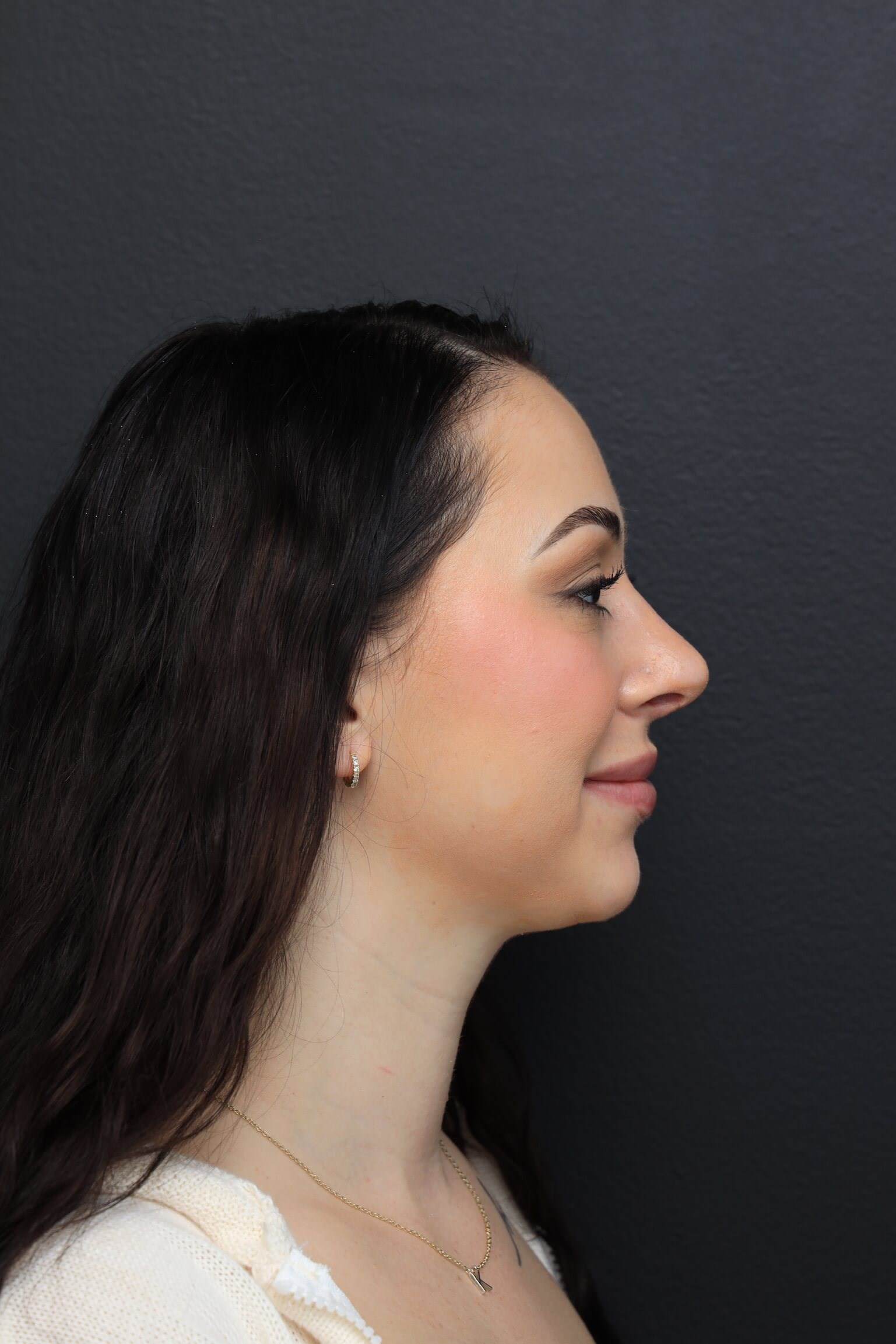 Right Lateral After
