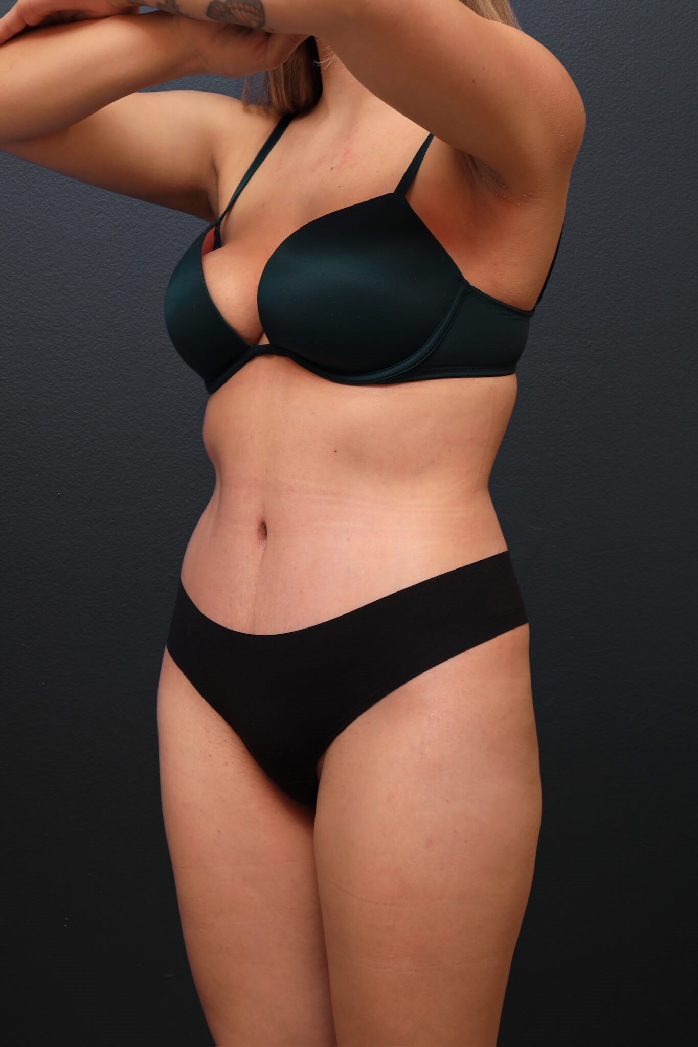 Left Oblique After