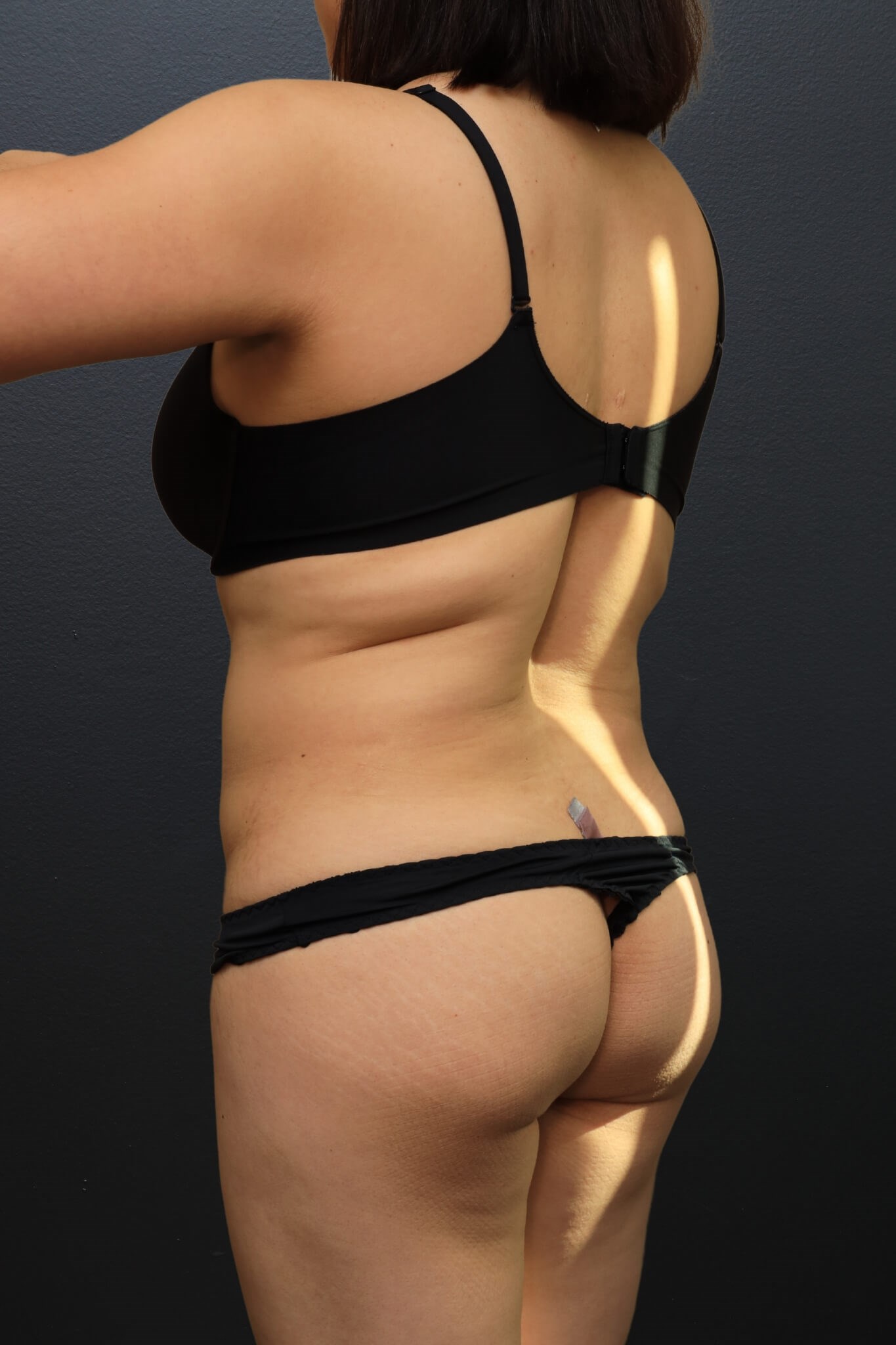Left Posterior Oblique Before