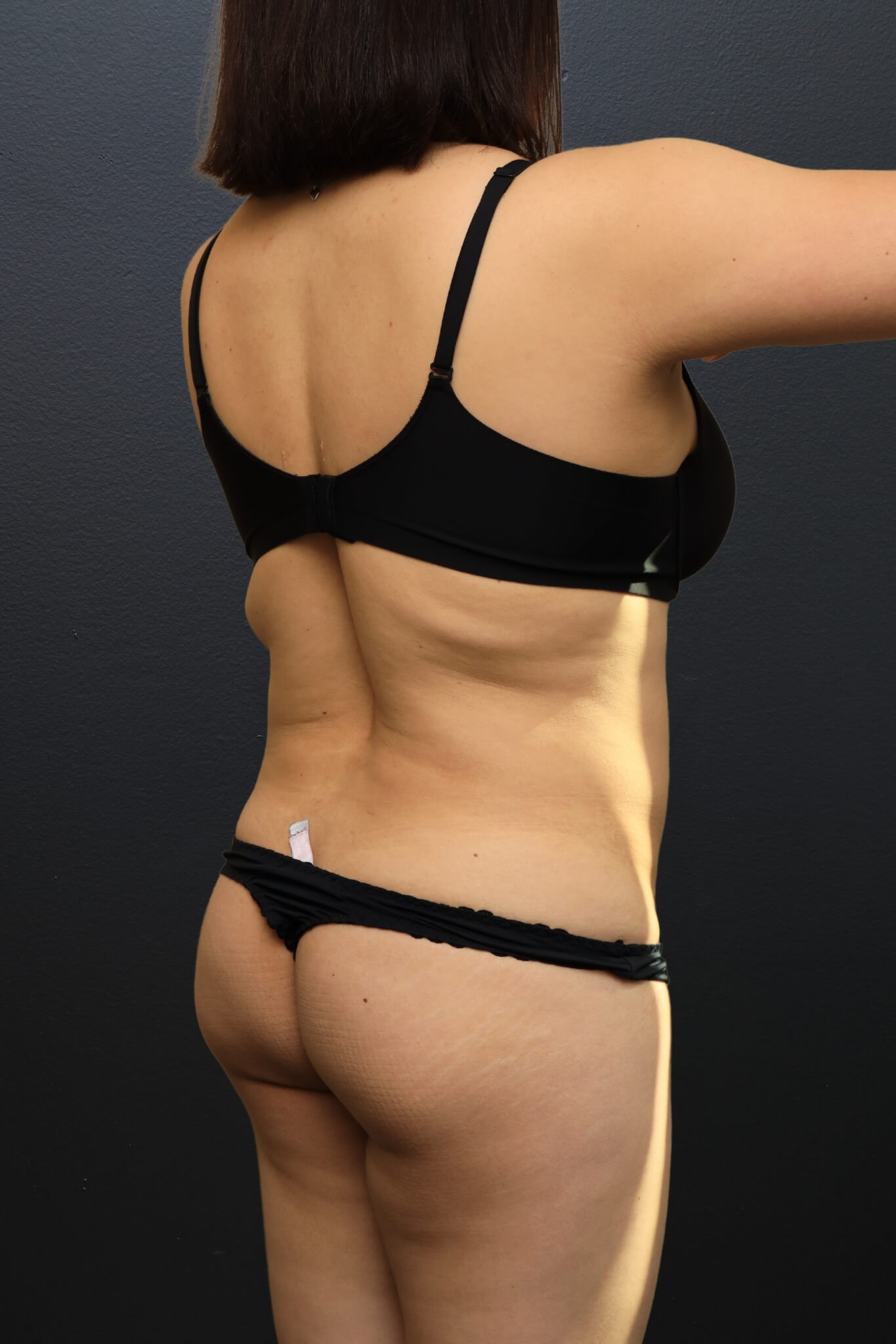 Right Posterior Oblique Before