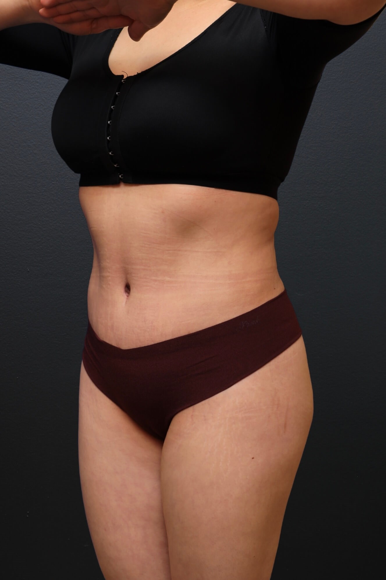 Left Oblique After