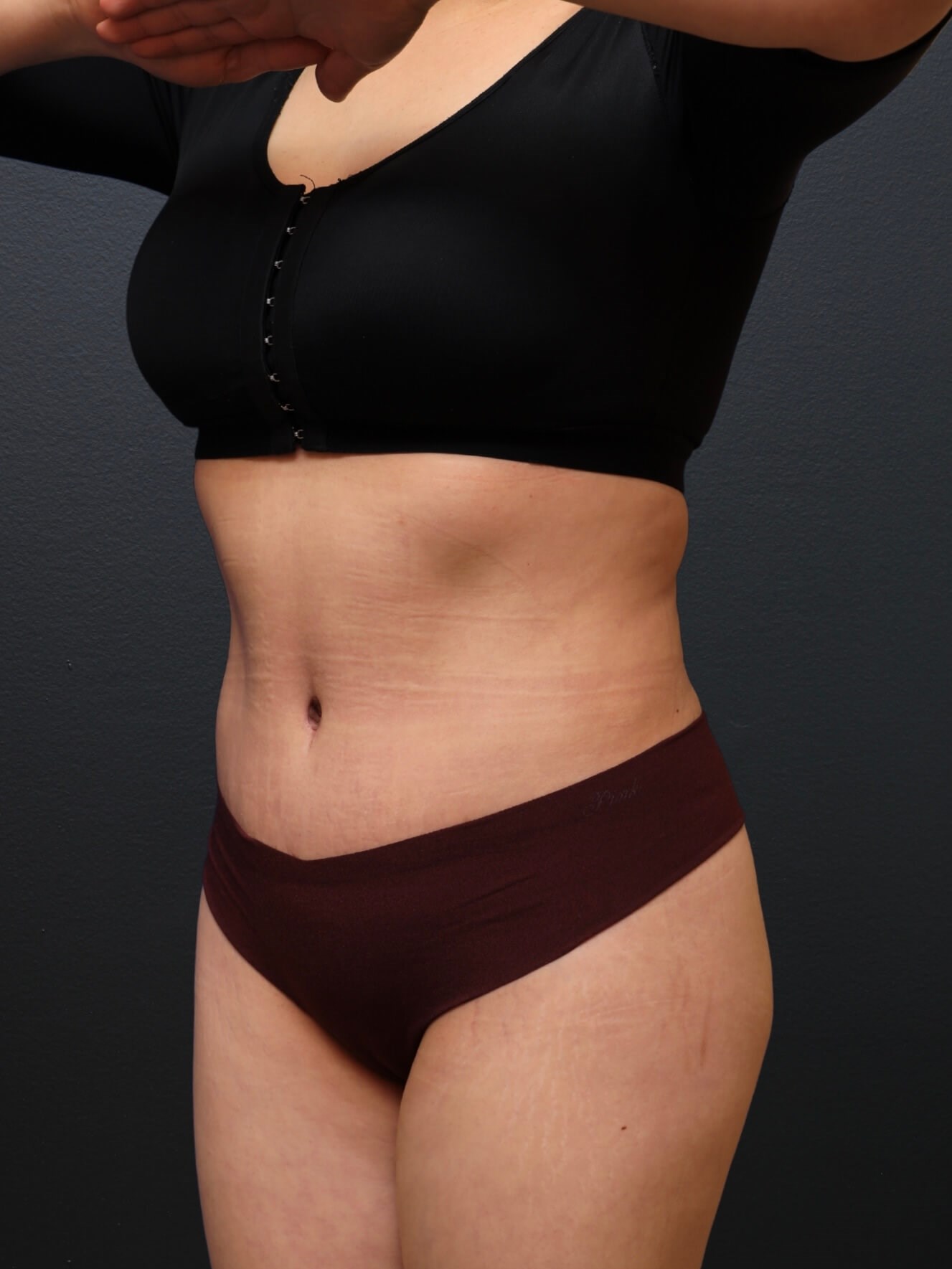 Left Oblique After