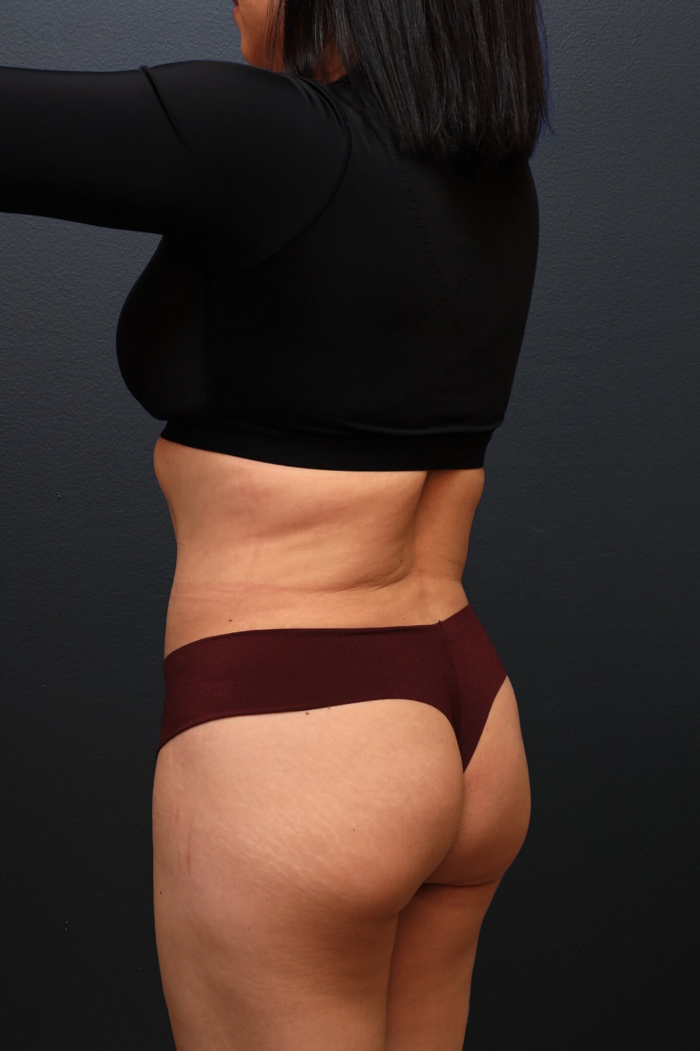 Left Posterior Oblique After
