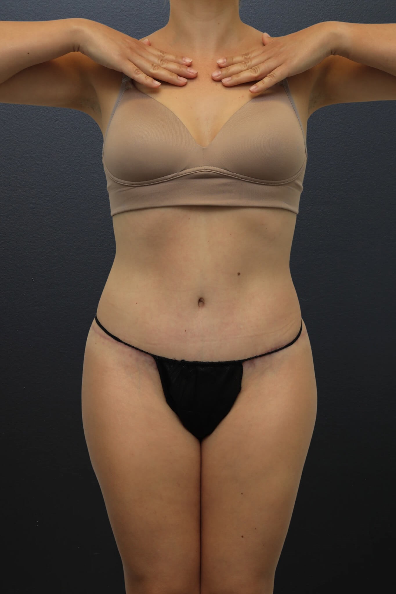After Image