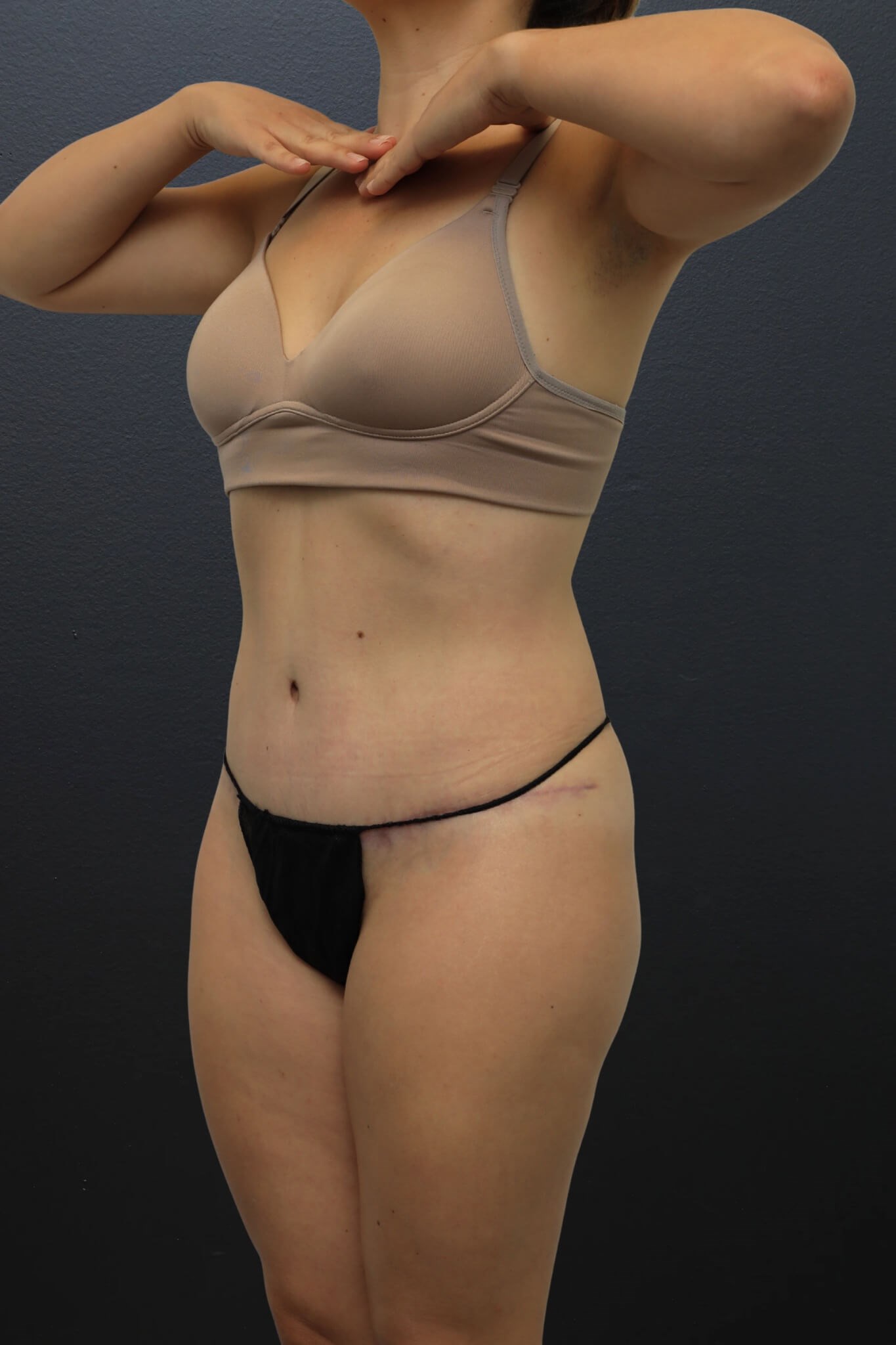 Left Oblique After