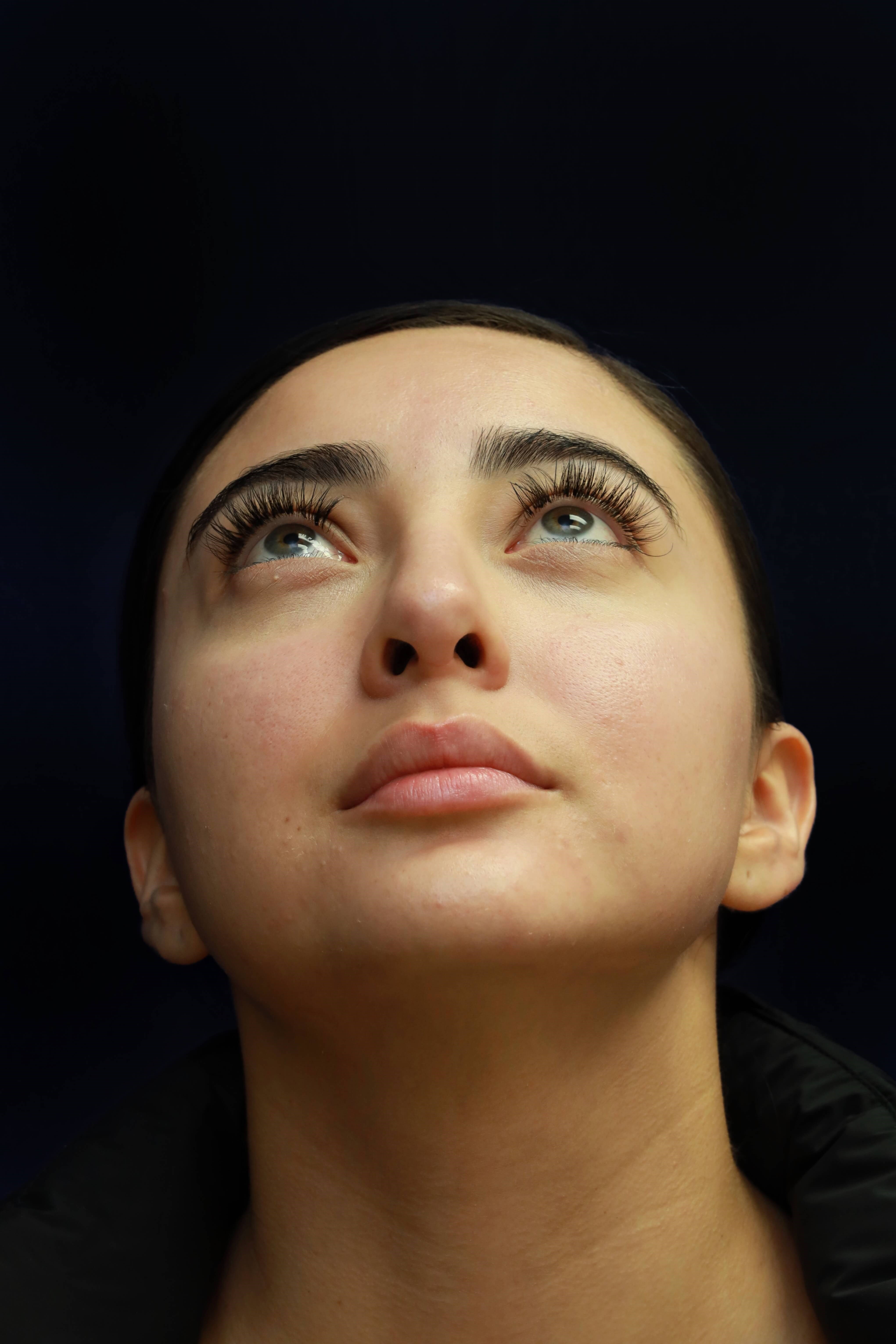 NASAL BASE After