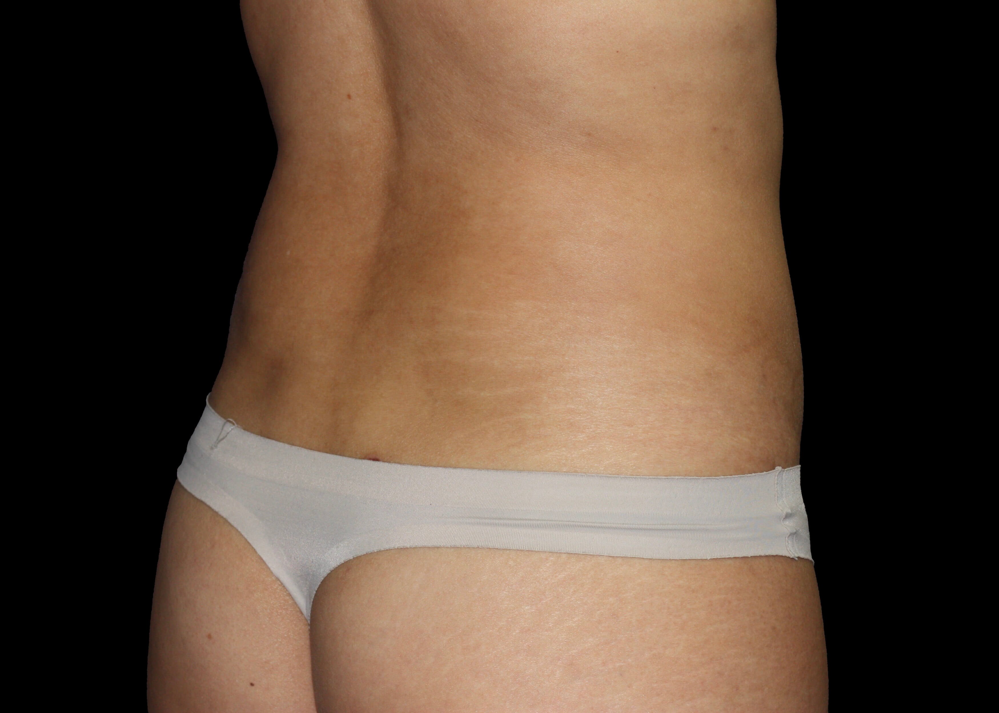 Right back oblique After