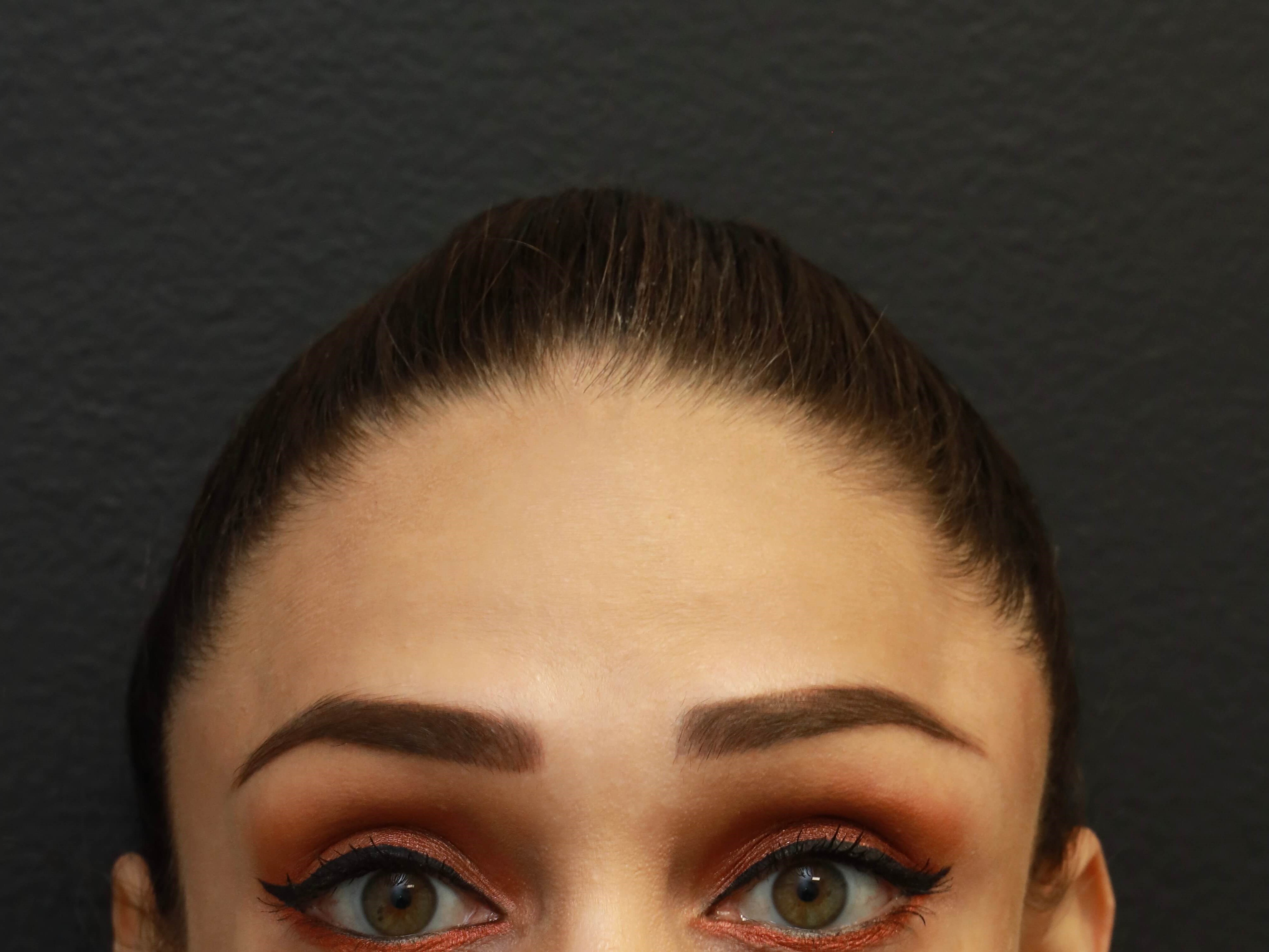 AP Eyebrows Raised Before
