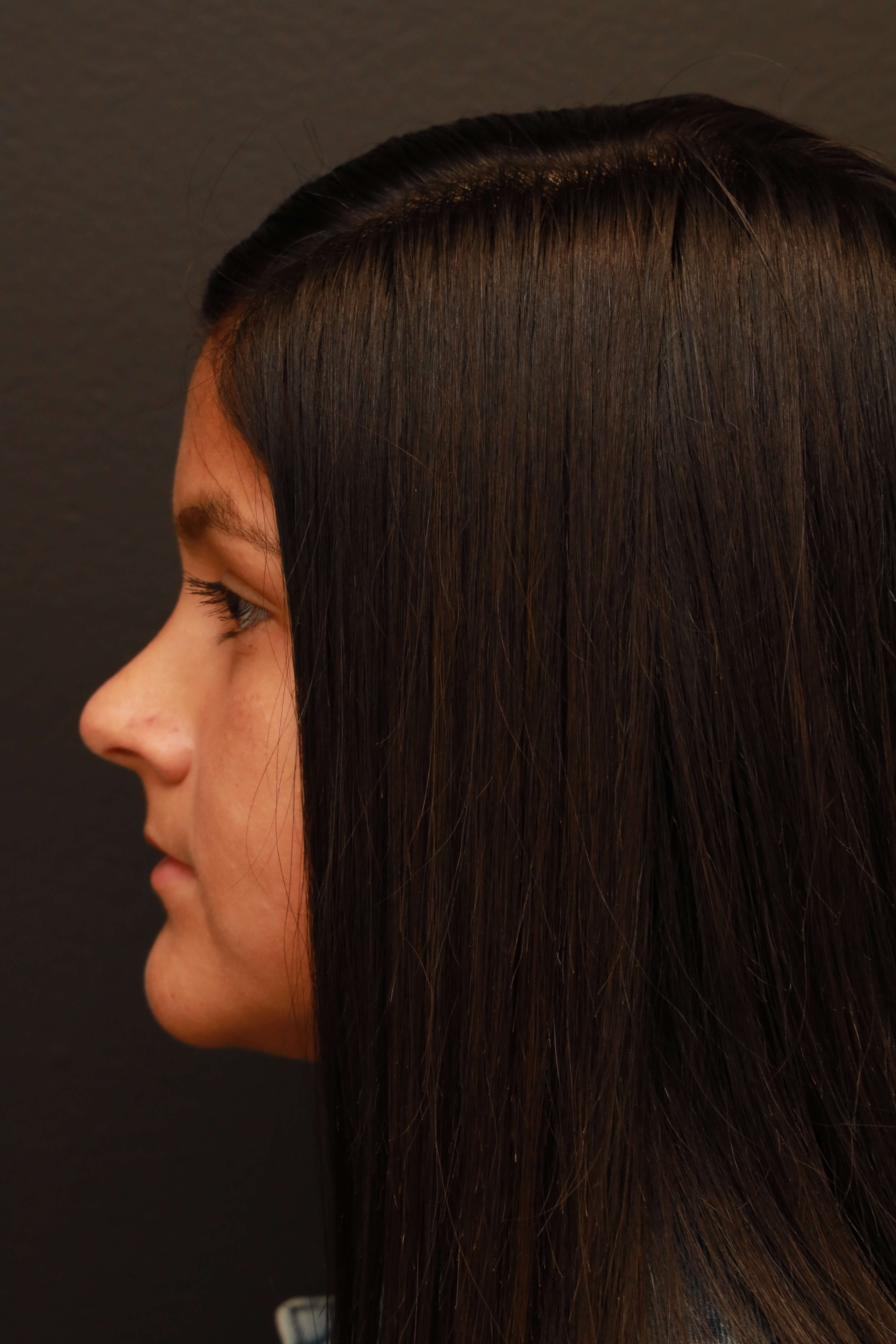 Left Lateral Before