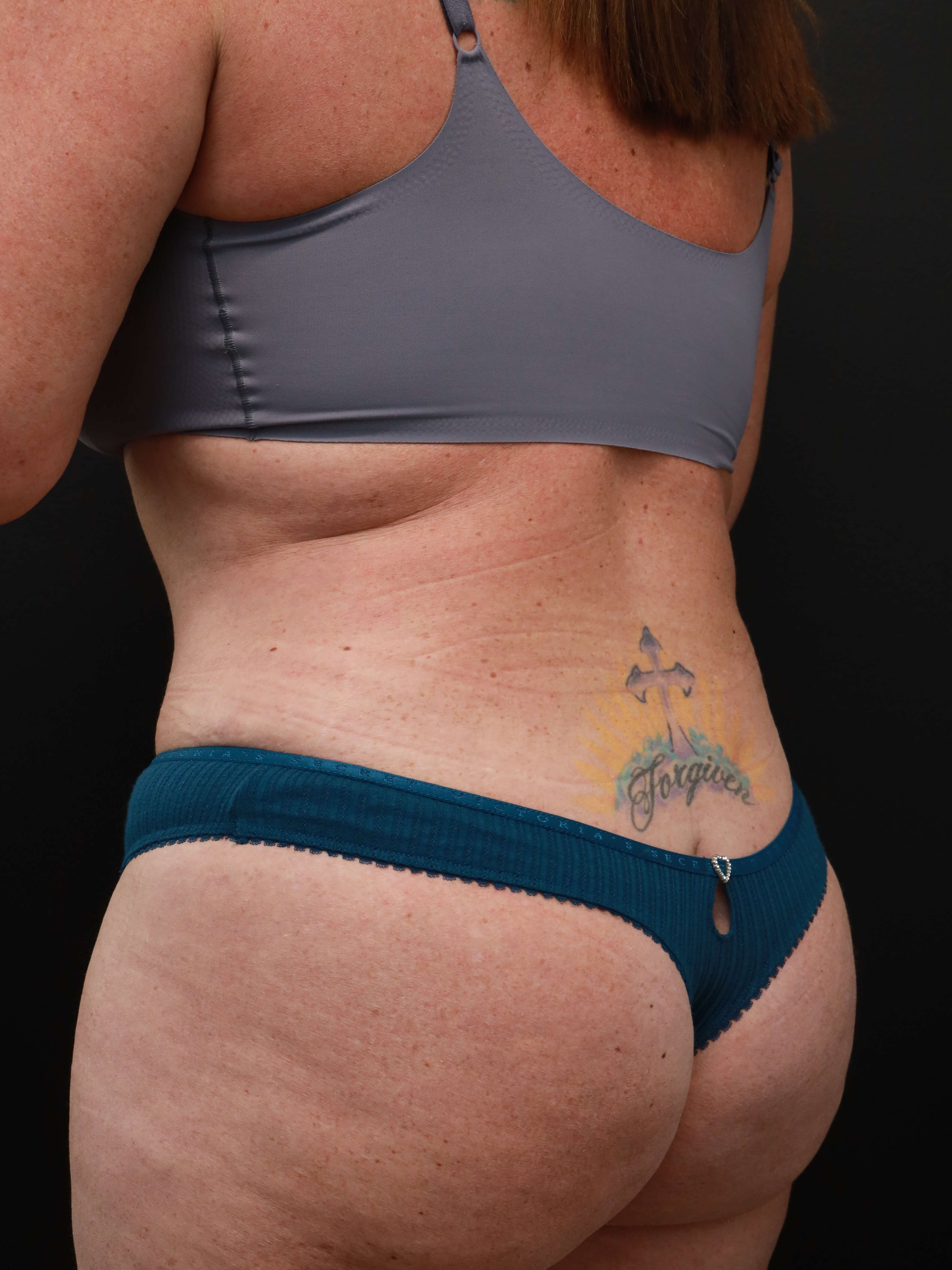 Left Back Oblique After