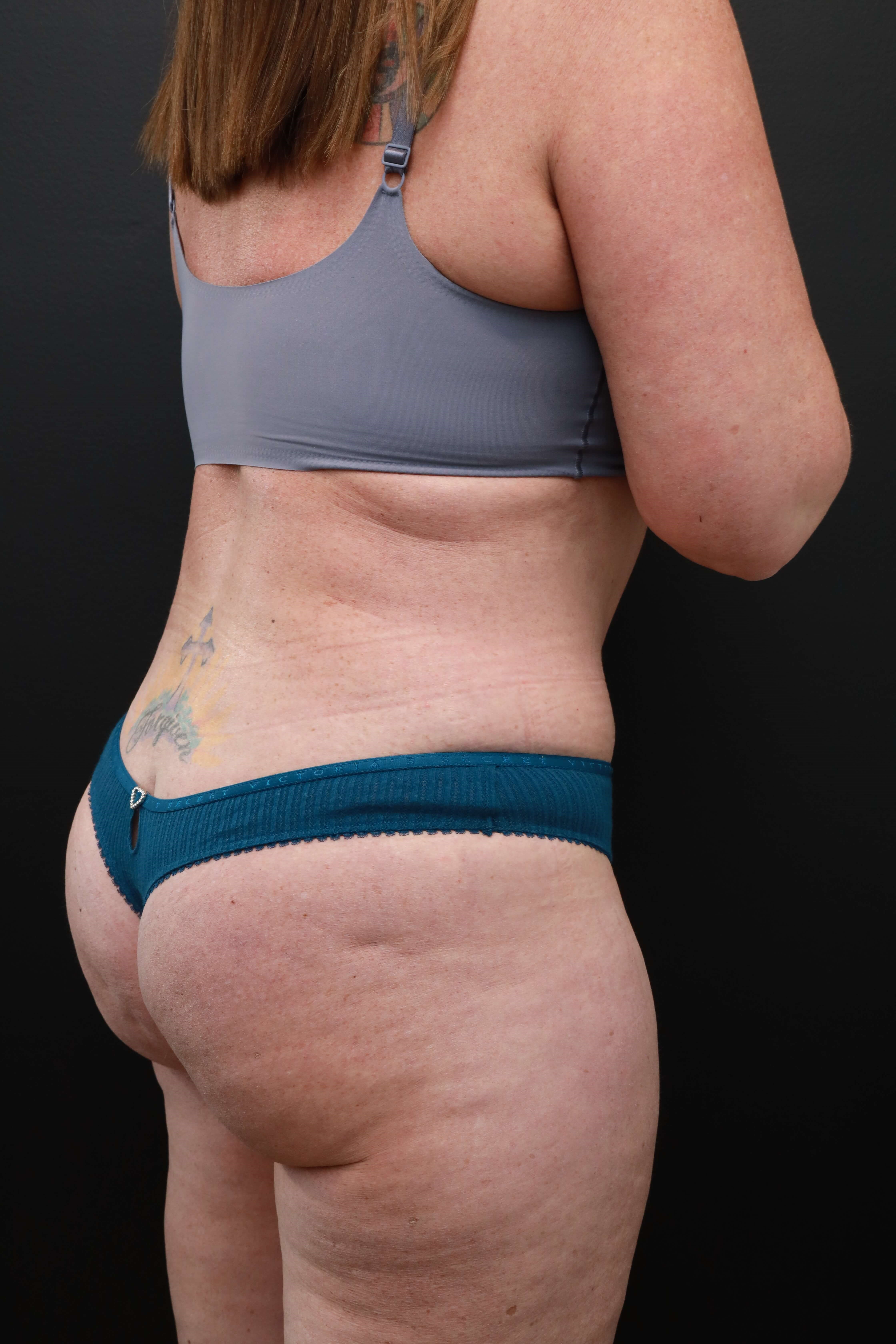 Right Back Oblique After